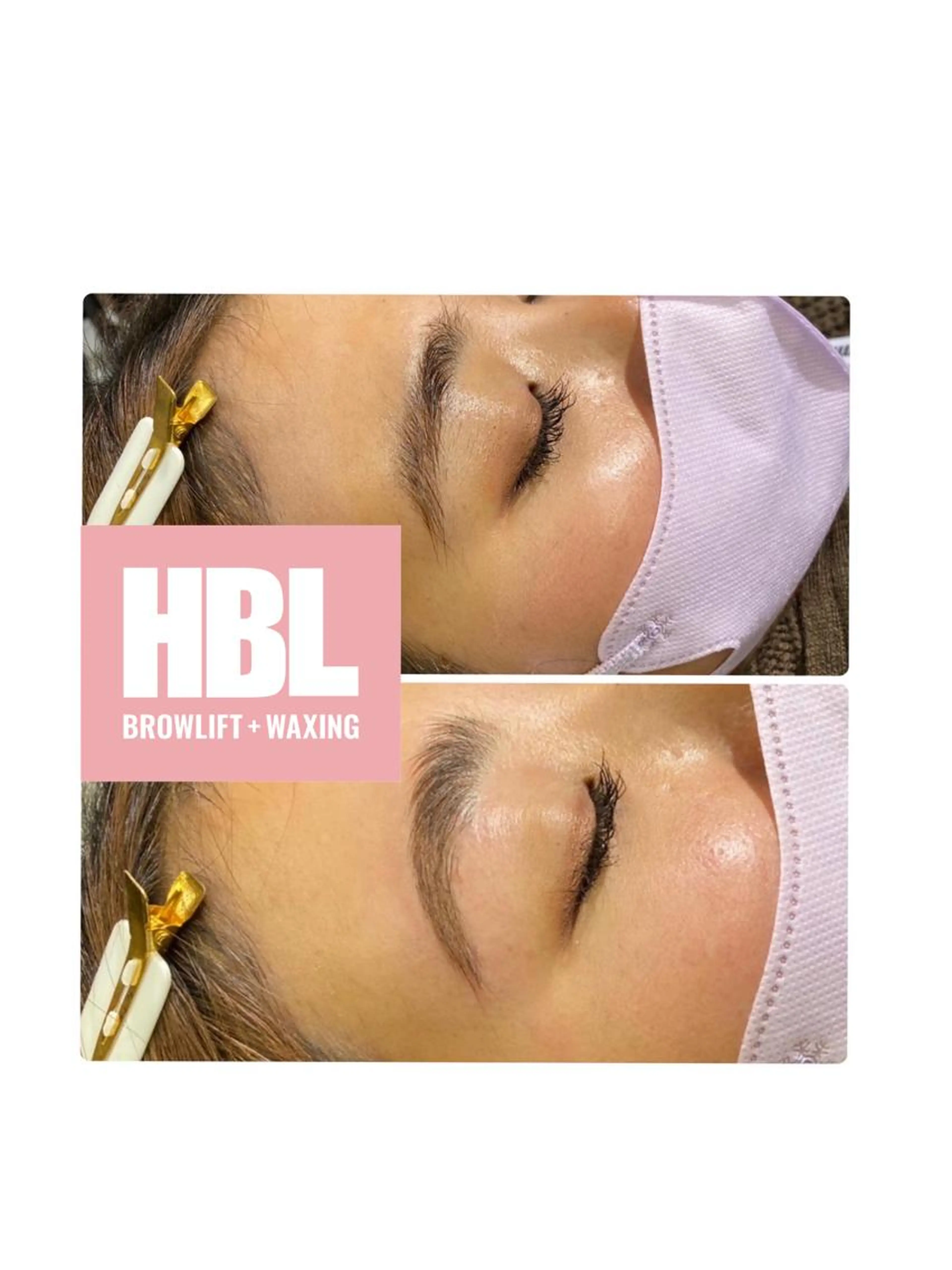 HBL（眉周りWax含む）の写真