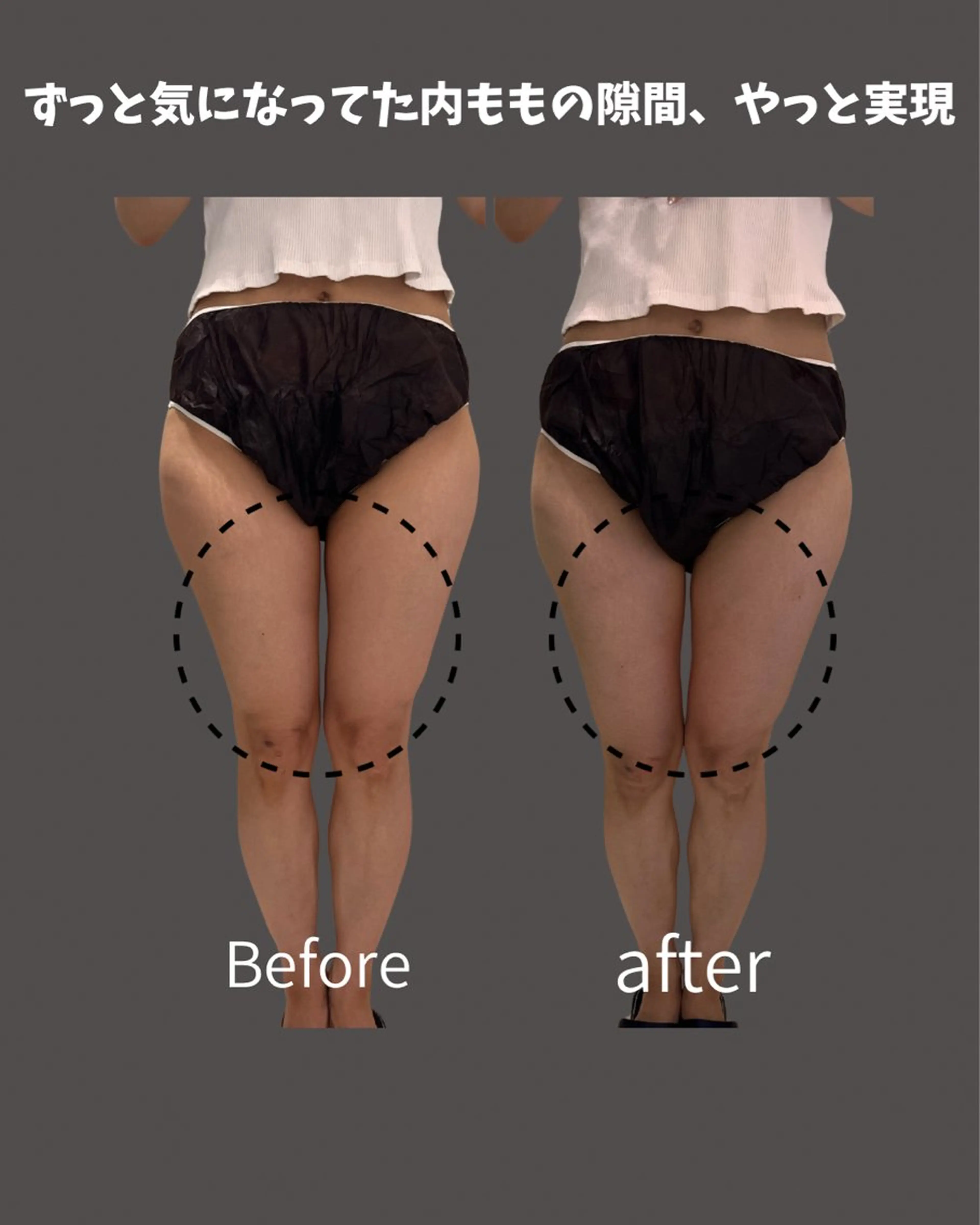 エステ UNA 福岡のエステ・リラクイメージ