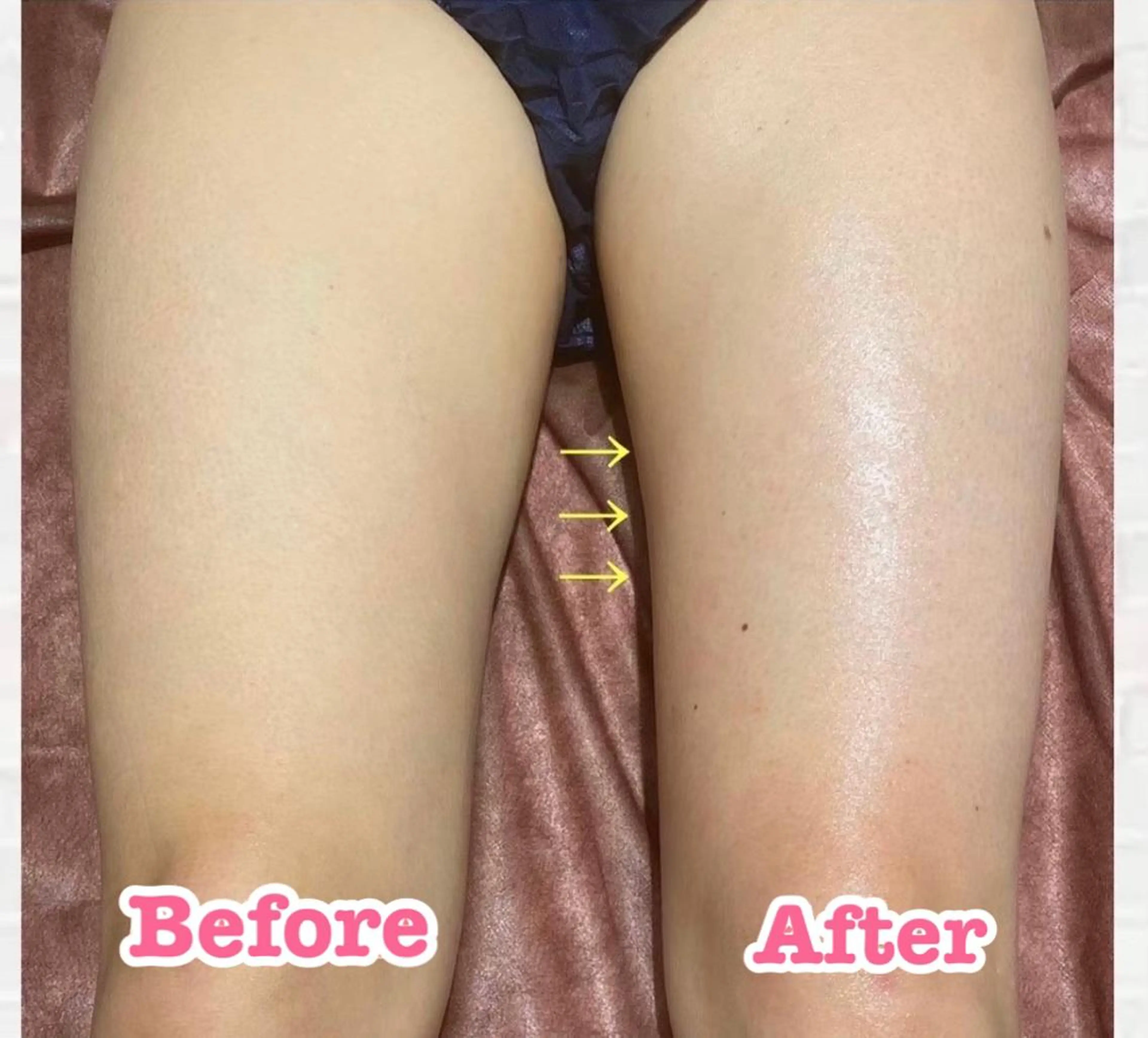 VICTOIRE HAKODATEのエステ・リラクイメージ