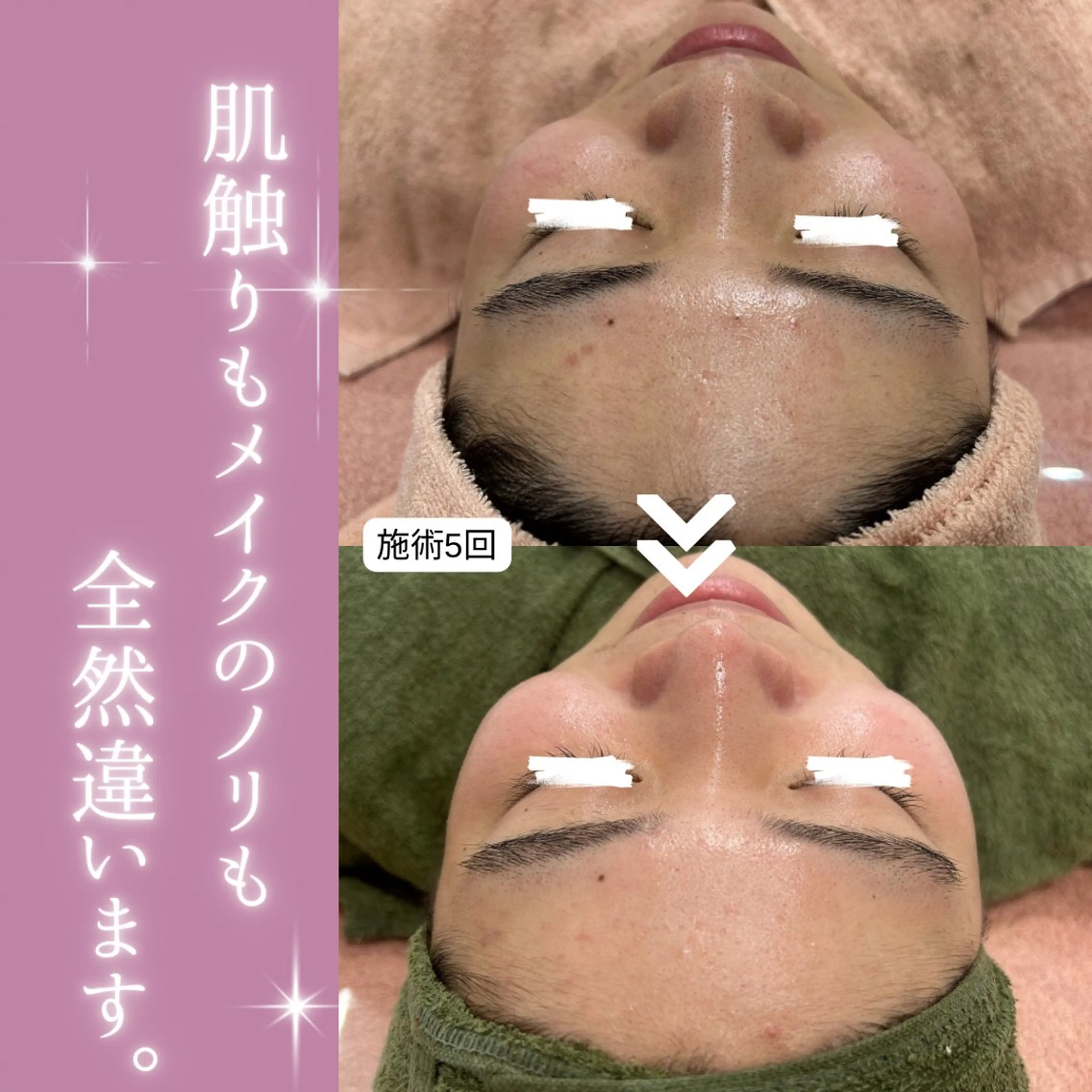 【現役看護師】高来 笑子のエステ・リラクイメージ