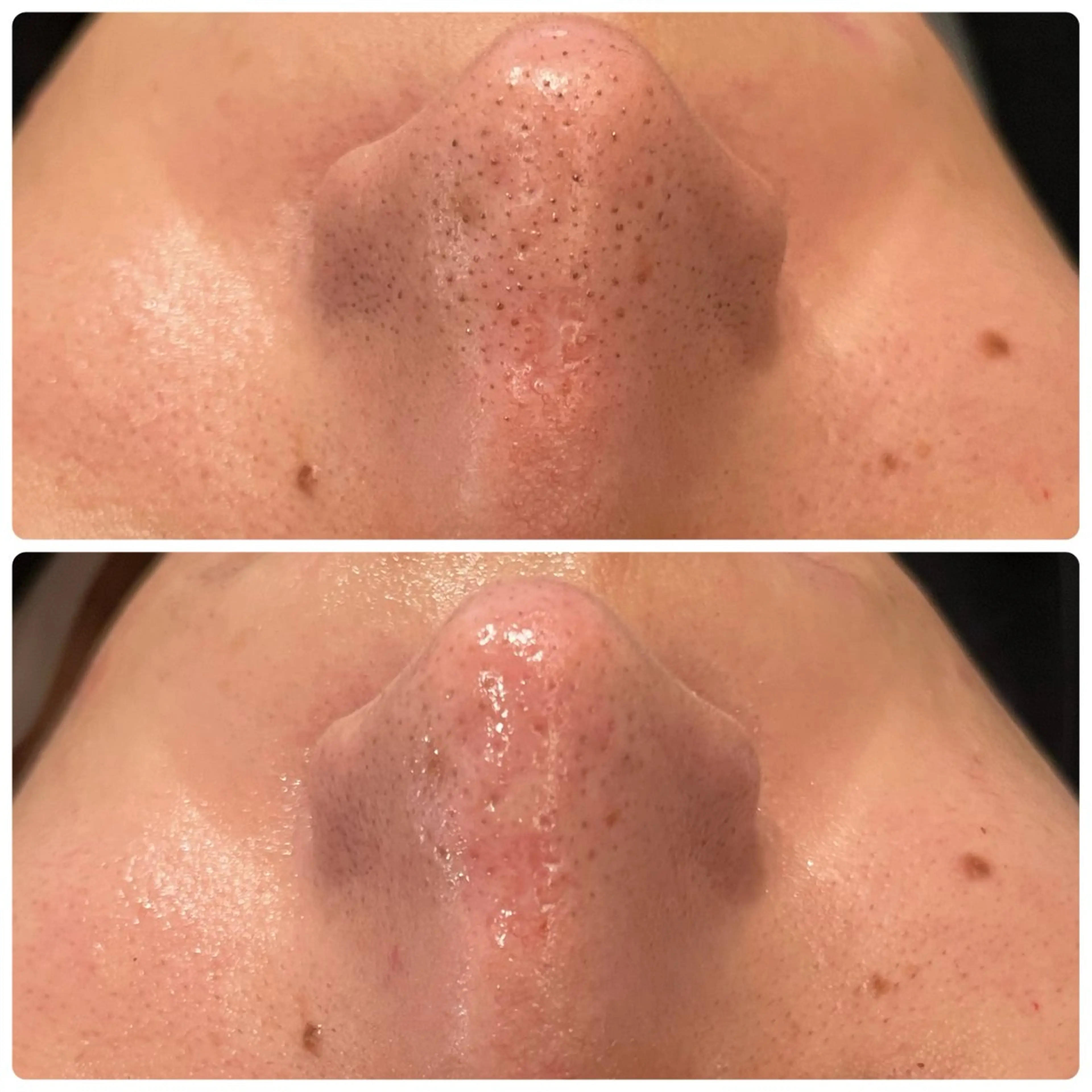 その他 yellow.所属・yellow💛【 脱毛&フェイシャル】のエステ・リラクイメージ