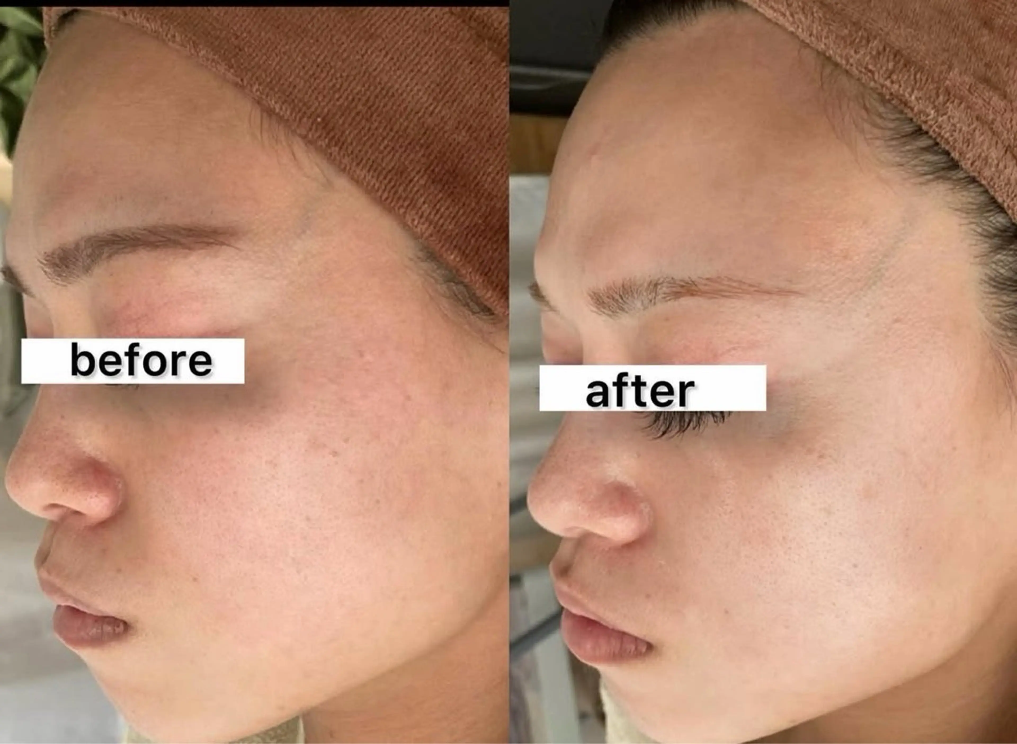 脱毛 RILsalon 脱毛/フェイシャルのエステ・リラクイメージ