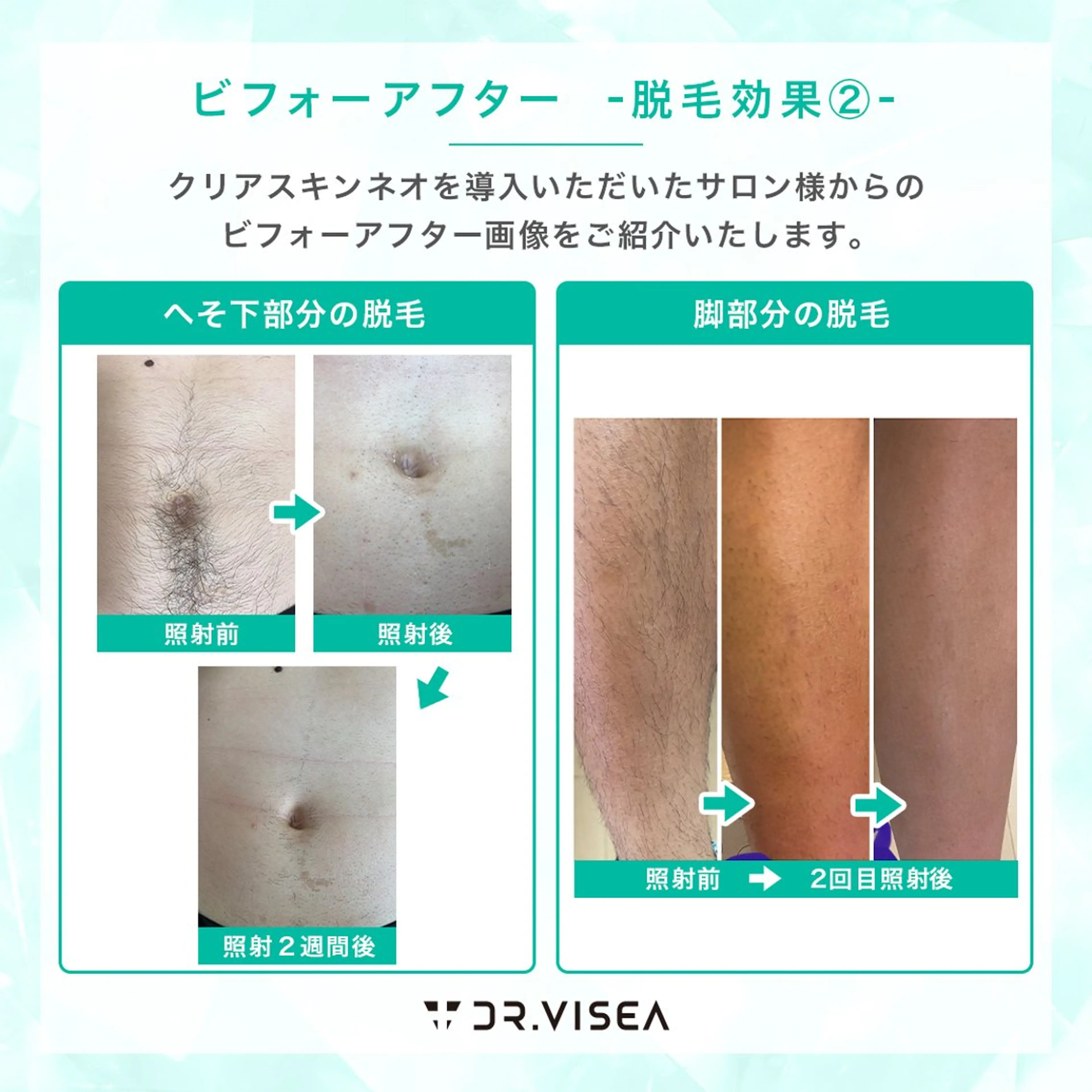 プライベートサロン Avenirのエステ・リラクイメージ