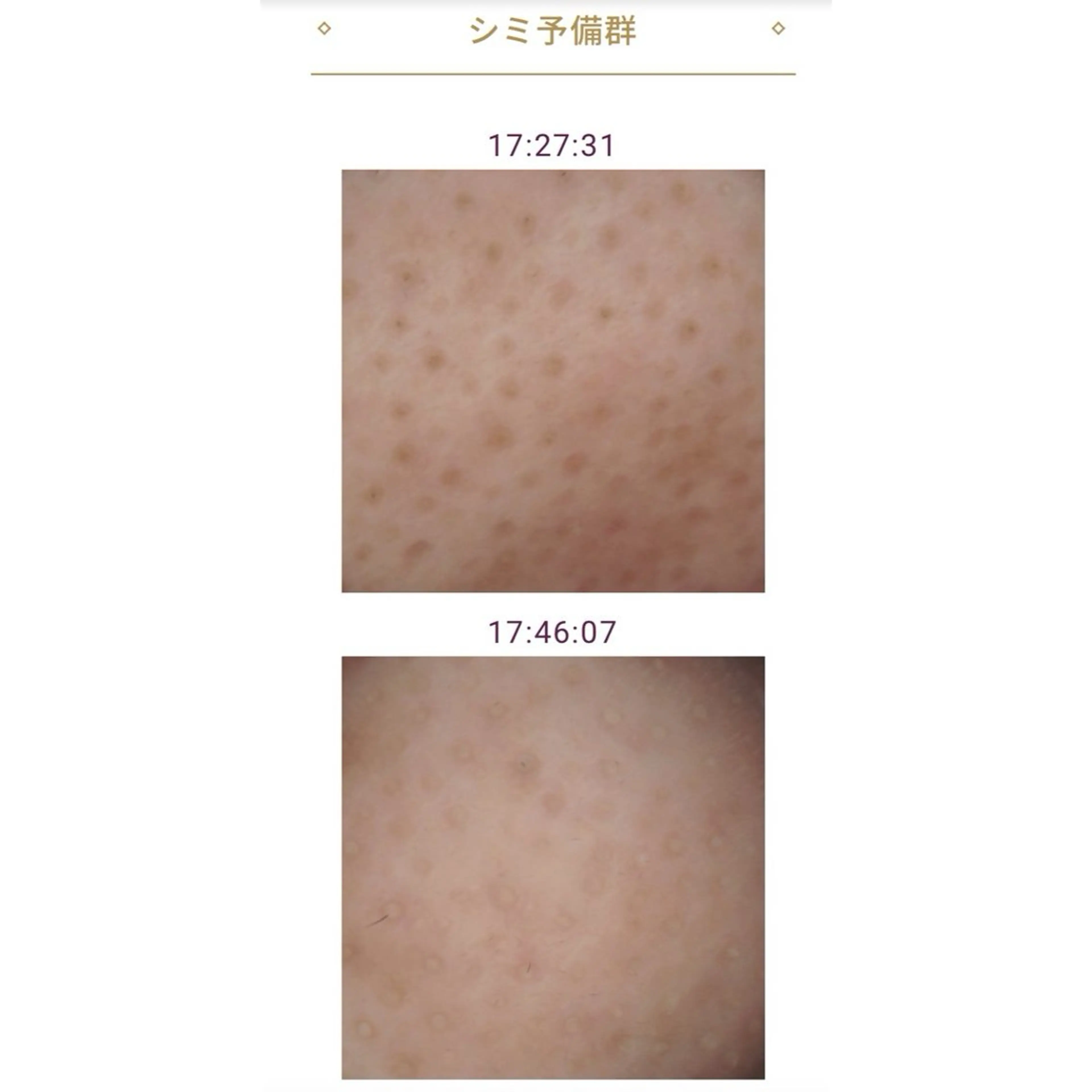 瑞穂区丸の内メナード 横山ともみのエステ・リラクイメージ