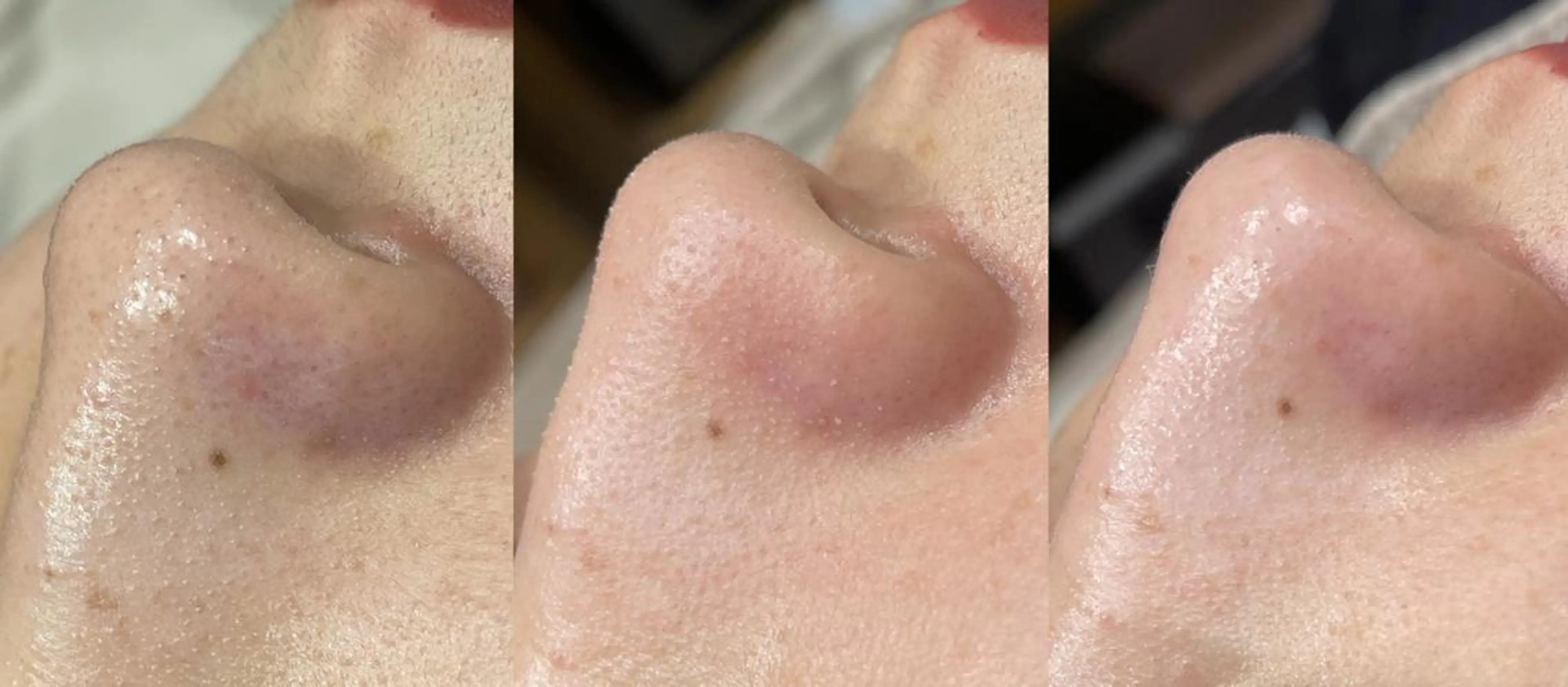 エステ sii MIUのエステ・リラクイメージ