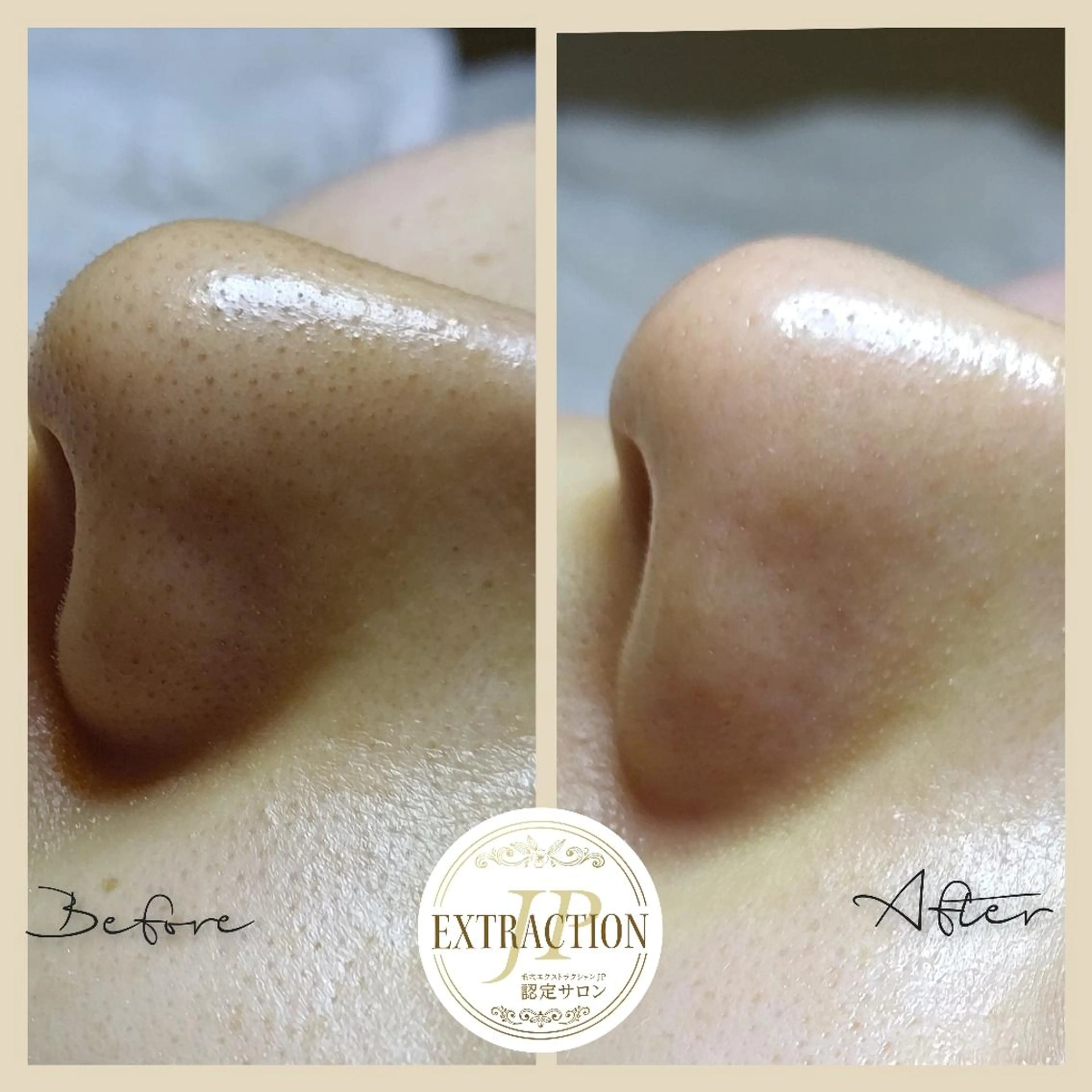 エステ 川口 春奈のエステ・リラクイメージ