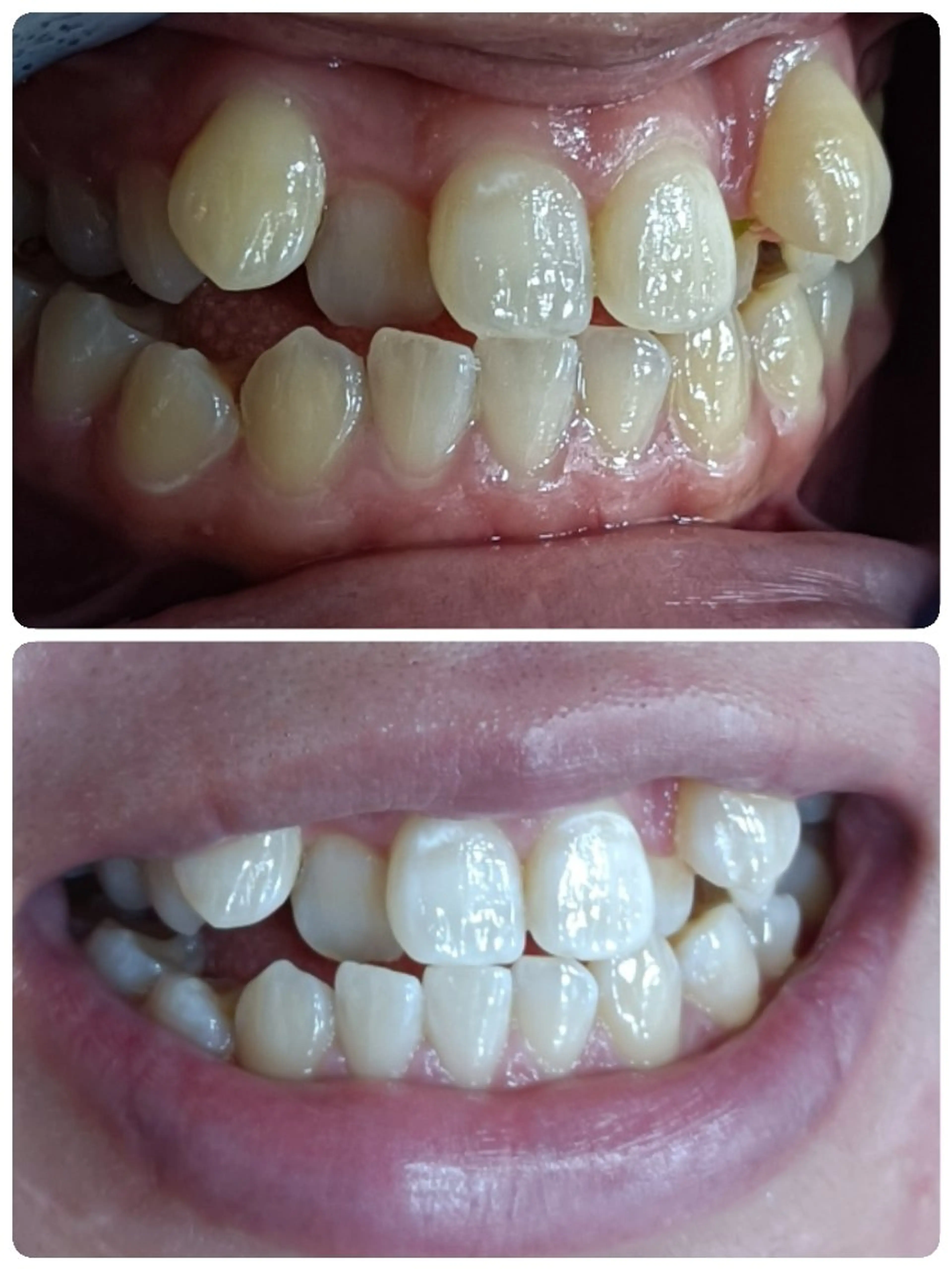 メンズ キッズ セルフホワイトニング メーカー直営サロンのエステ・リラクイメージ