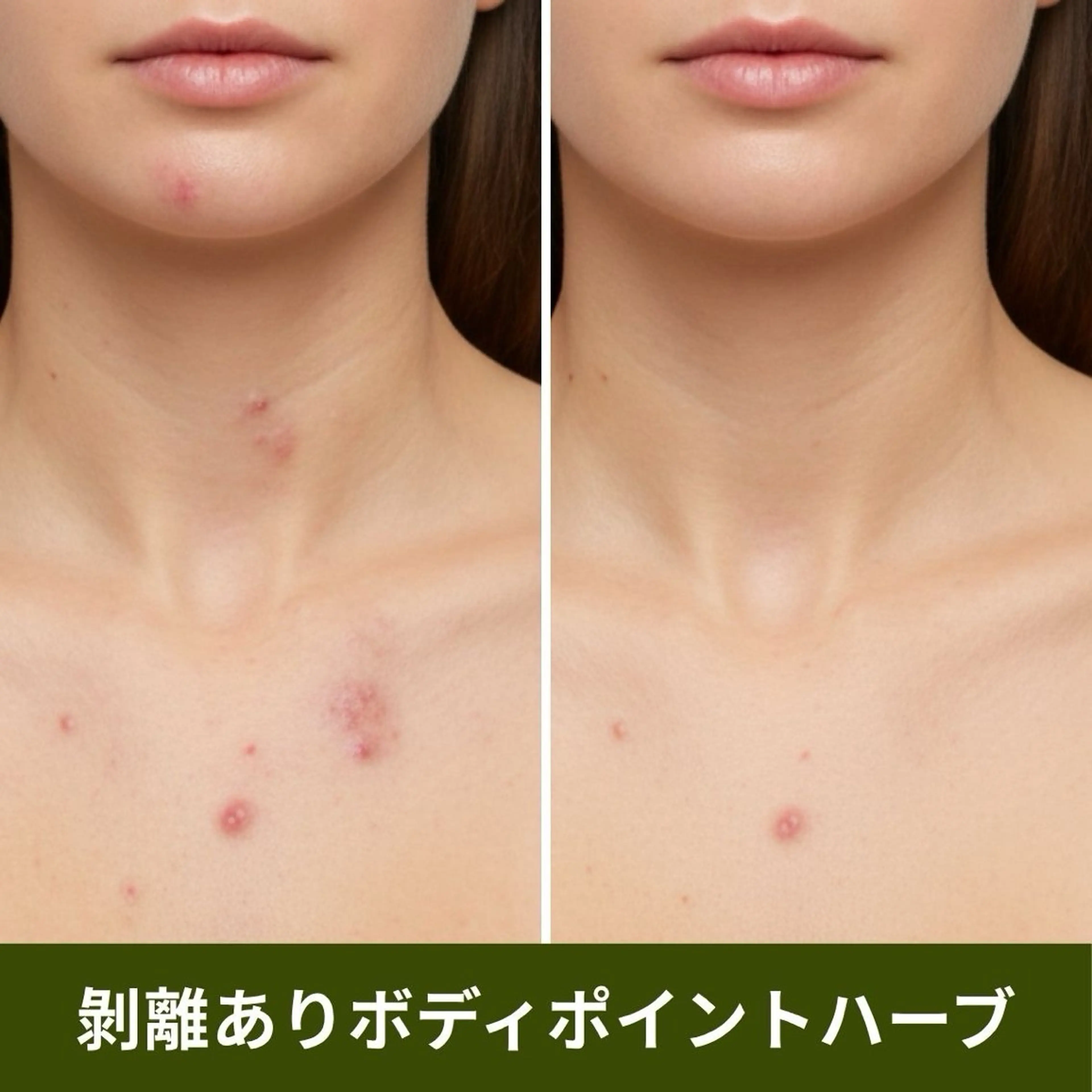 【ポイント施術】ボディハーブピーリング(剥離あり)ヒト幹細胞培養上清液入りハーブ🌿お尻/背中上or下/デコルテ/足/腕の写真