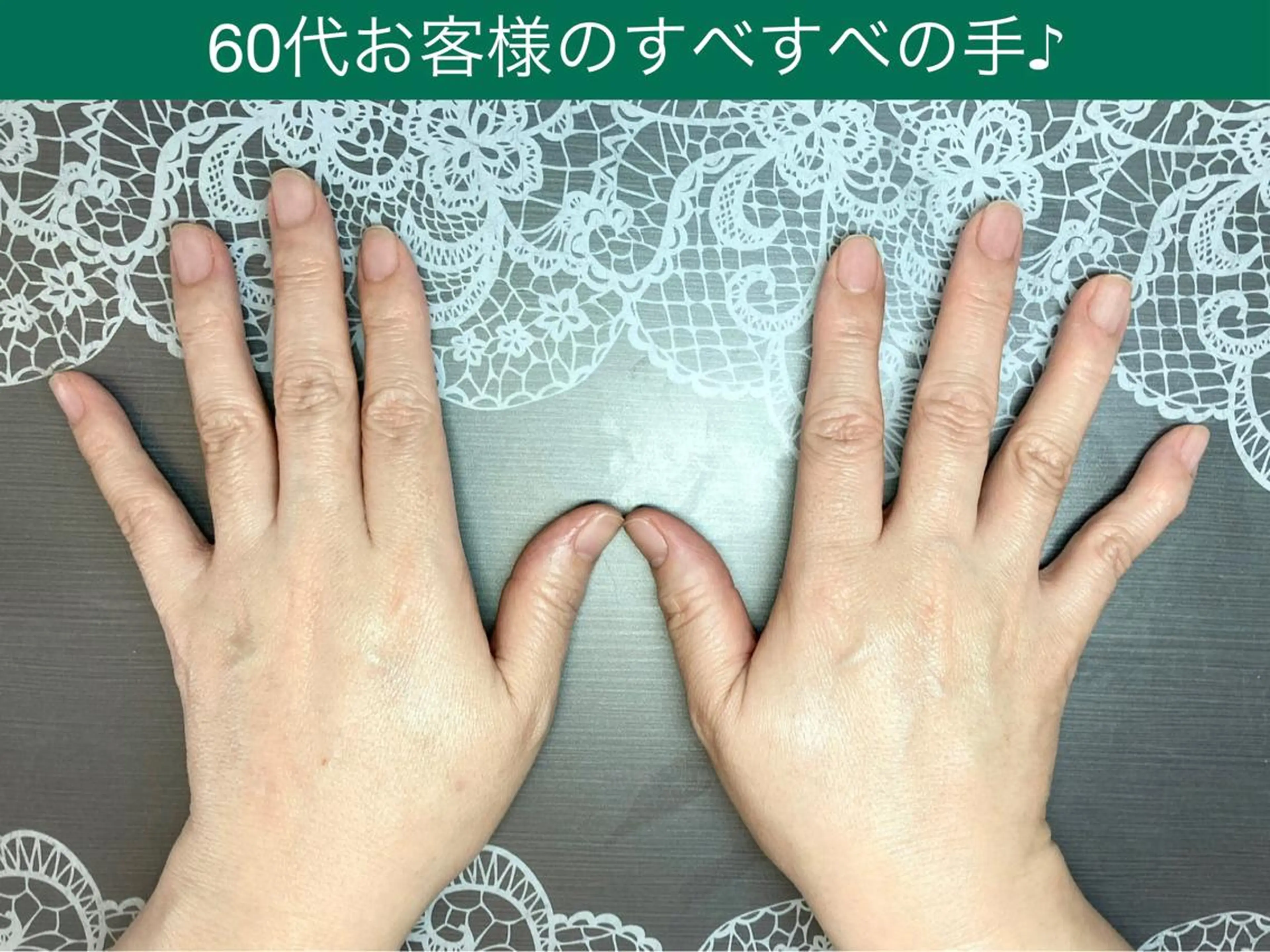 【再来】ハンドケア&ネイルケア シワ改善コース🌿手のエイジングケア8万円超えの韓国高麗人参シリーズ使用♪の写真