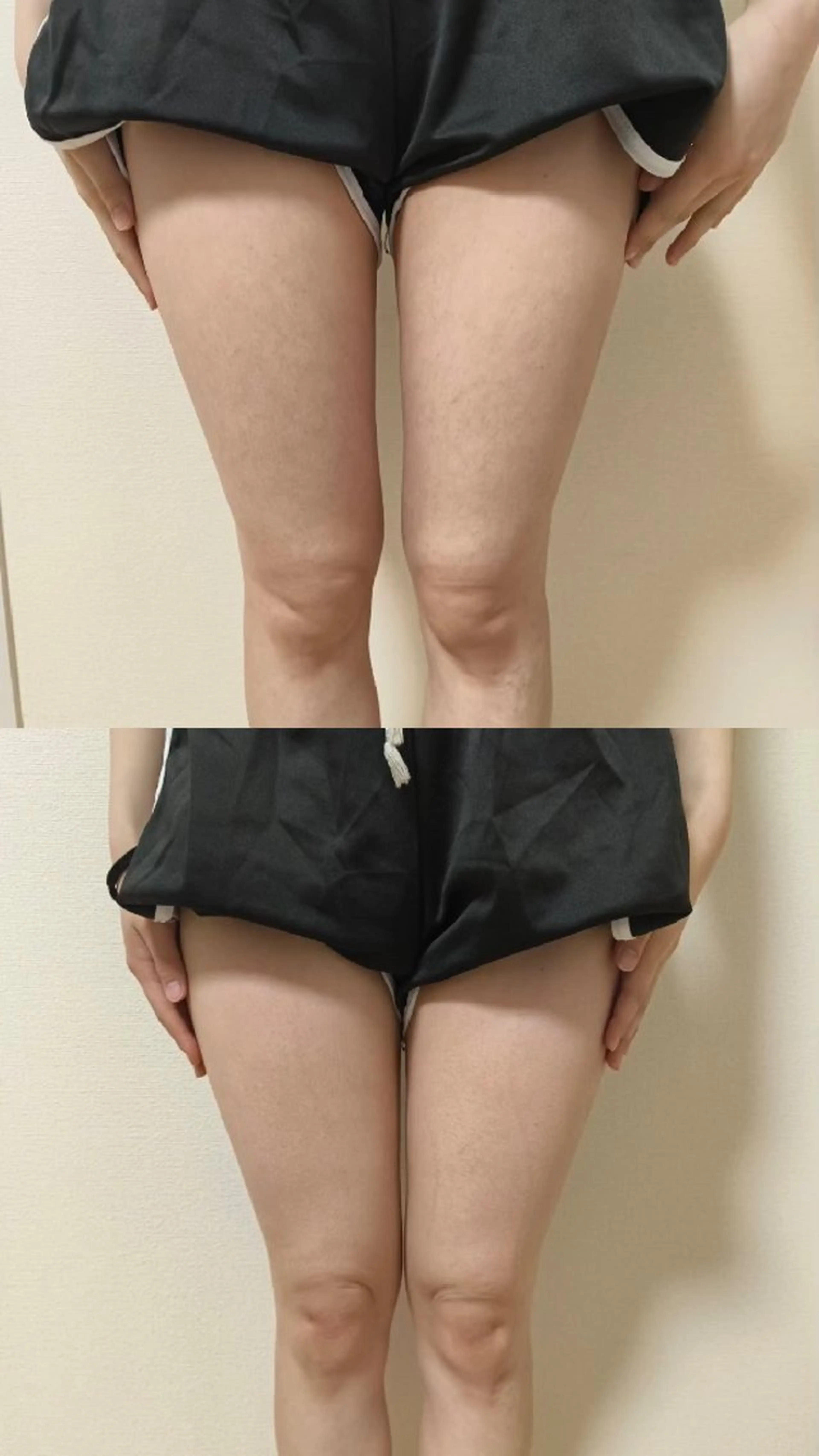 maryu 358のエステ・リラクイメージ