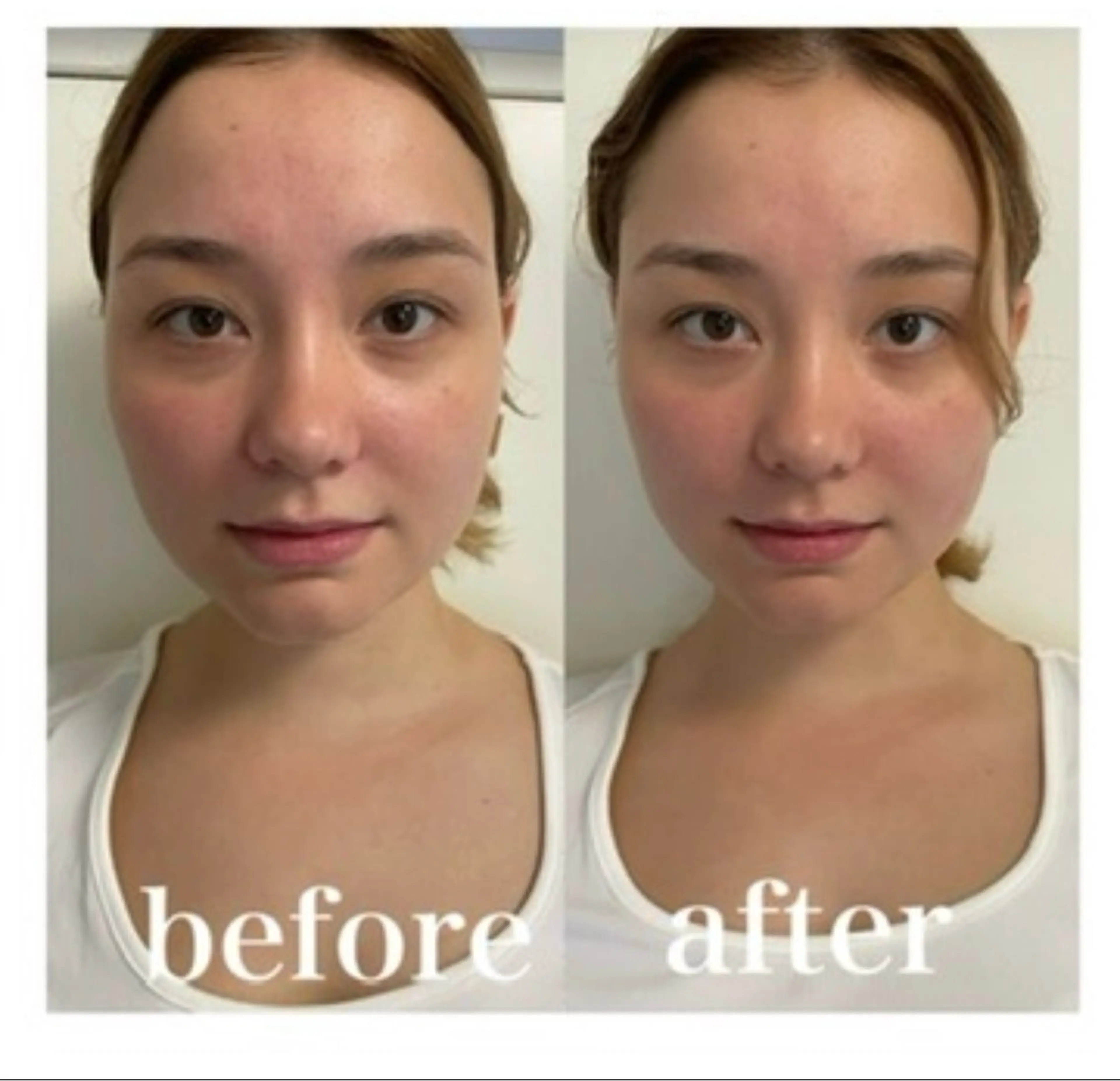 美容鍼灸サロン mahoroba院長のエステ・リラクイメージ