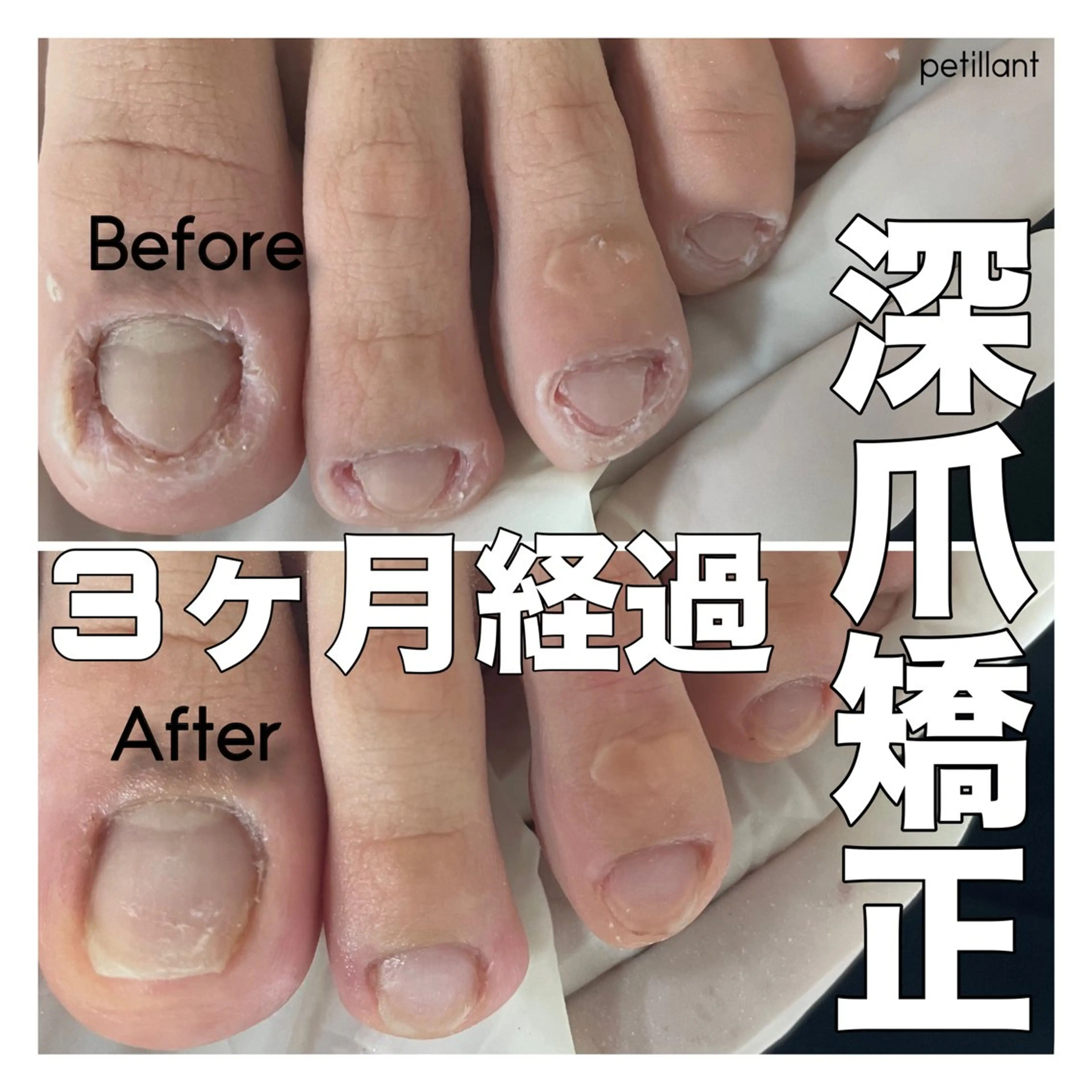 ネイル ジェルネイル nail salon petillantのネイルデザイン