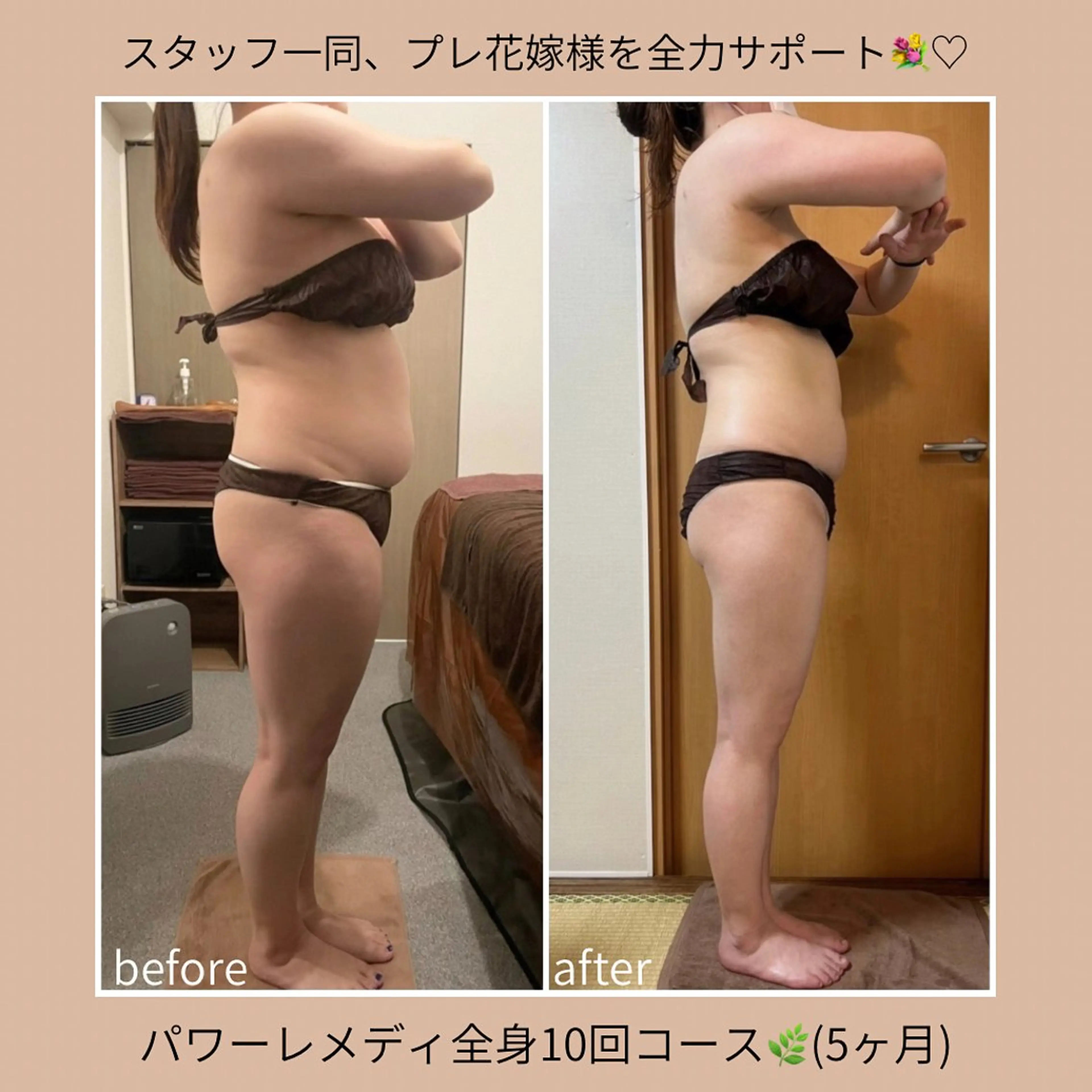 《本気痩せ×疲労改善 》  BILOOPのエステ・リラクイメージ