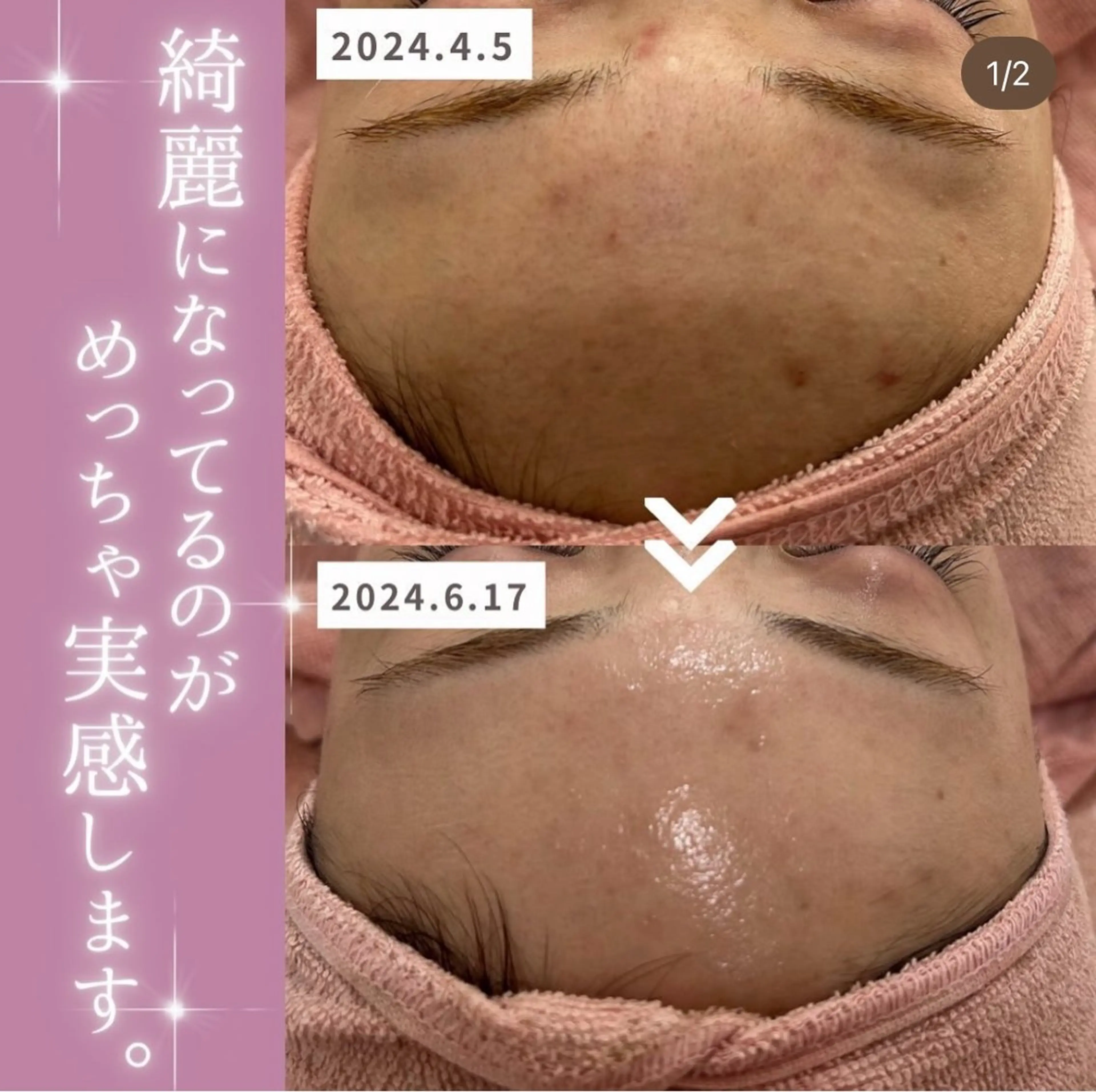 エステ 【現役看護師】高来 笑子のエステ・リラクイメージ