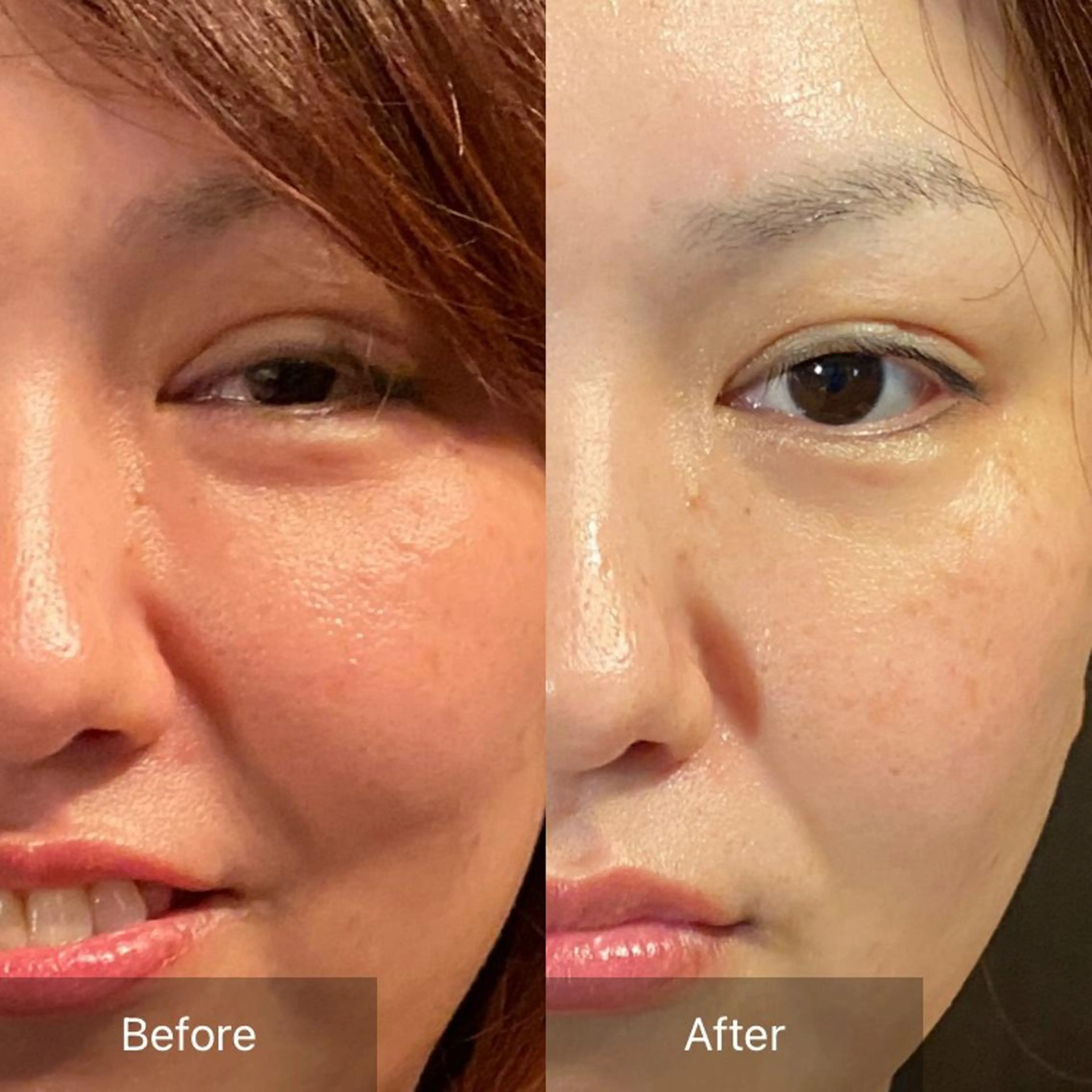 Mandarin Orange所属・毛穴から始める肌メン テマンダリンオレンジのエステ・リラクイメージ