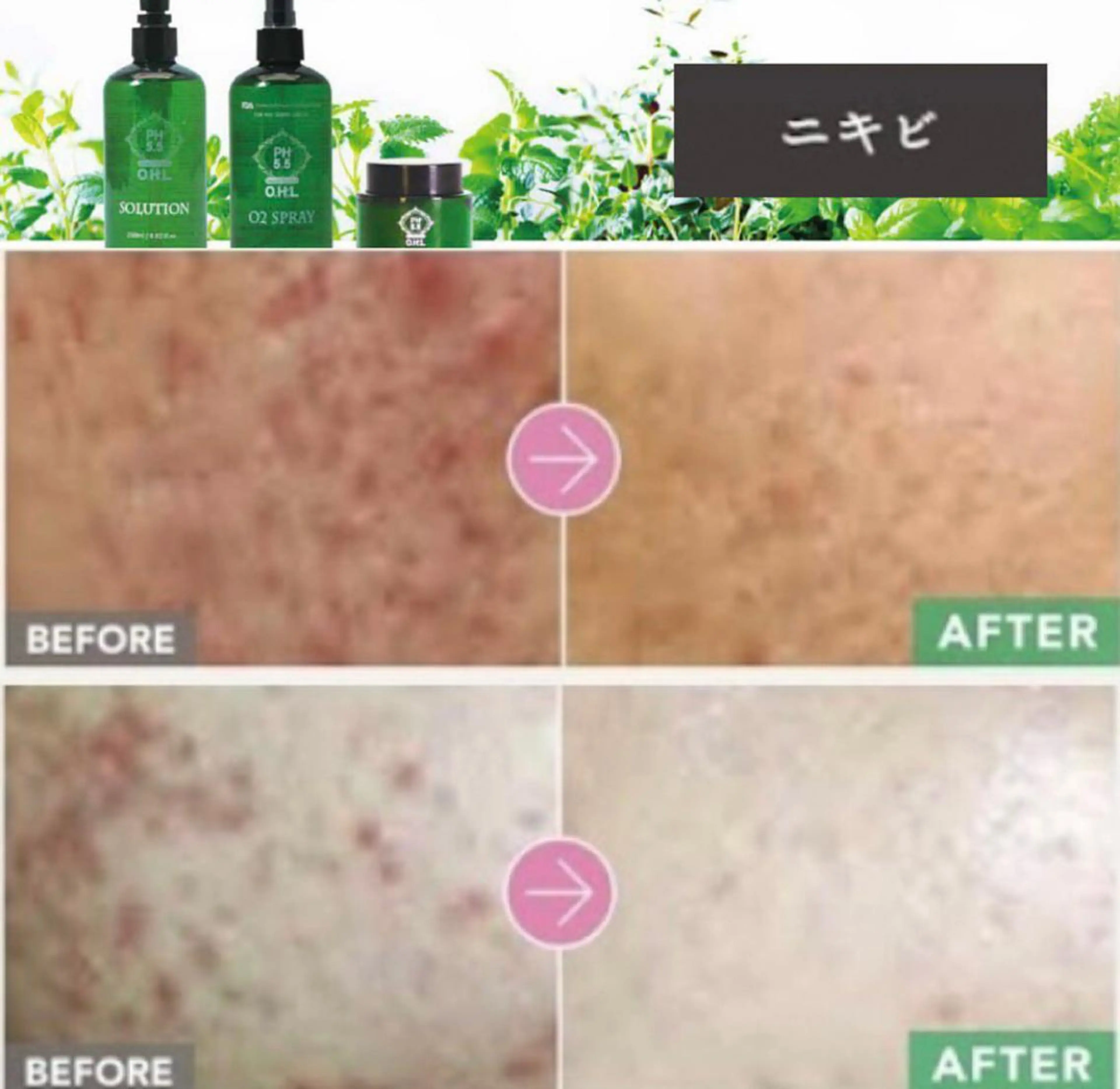 メンズ エステ リラク beauty salonnのエステ・リラクイメージ