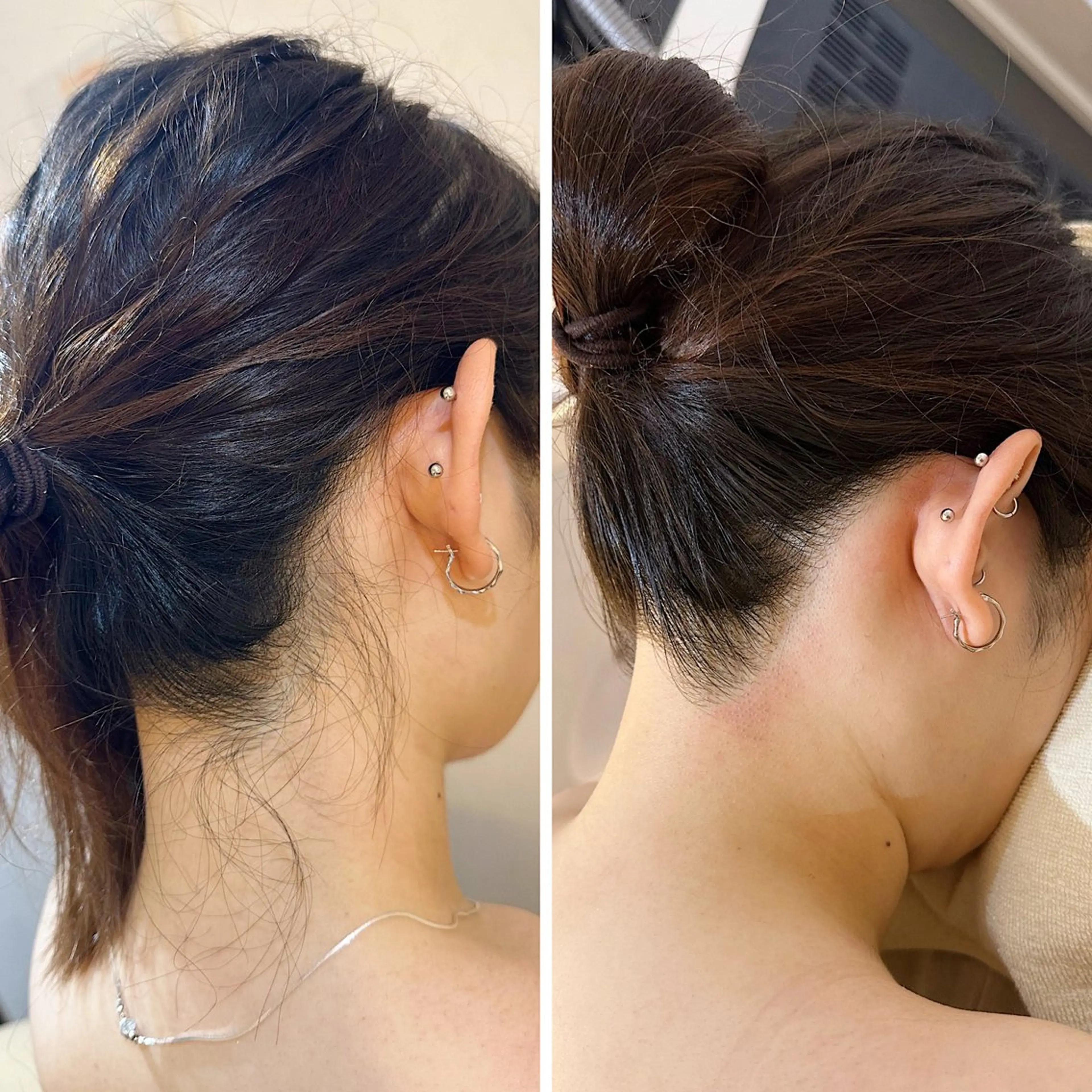 脱毛 うなじ脱毛/美肌脱毛 LABELのエステ・リラクイメージ