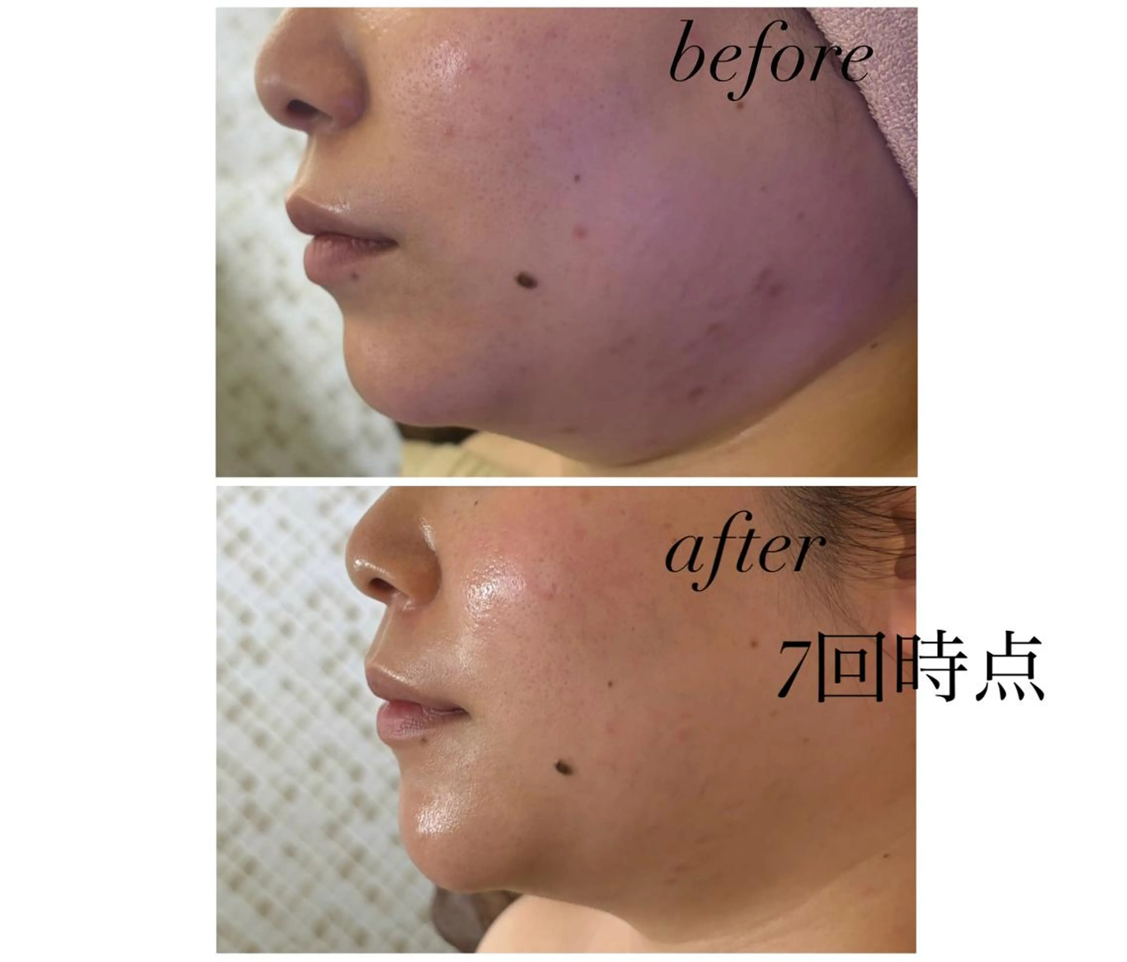 《美肌&小顔サロン》 Masqueradeのエステ・リラクイメージ