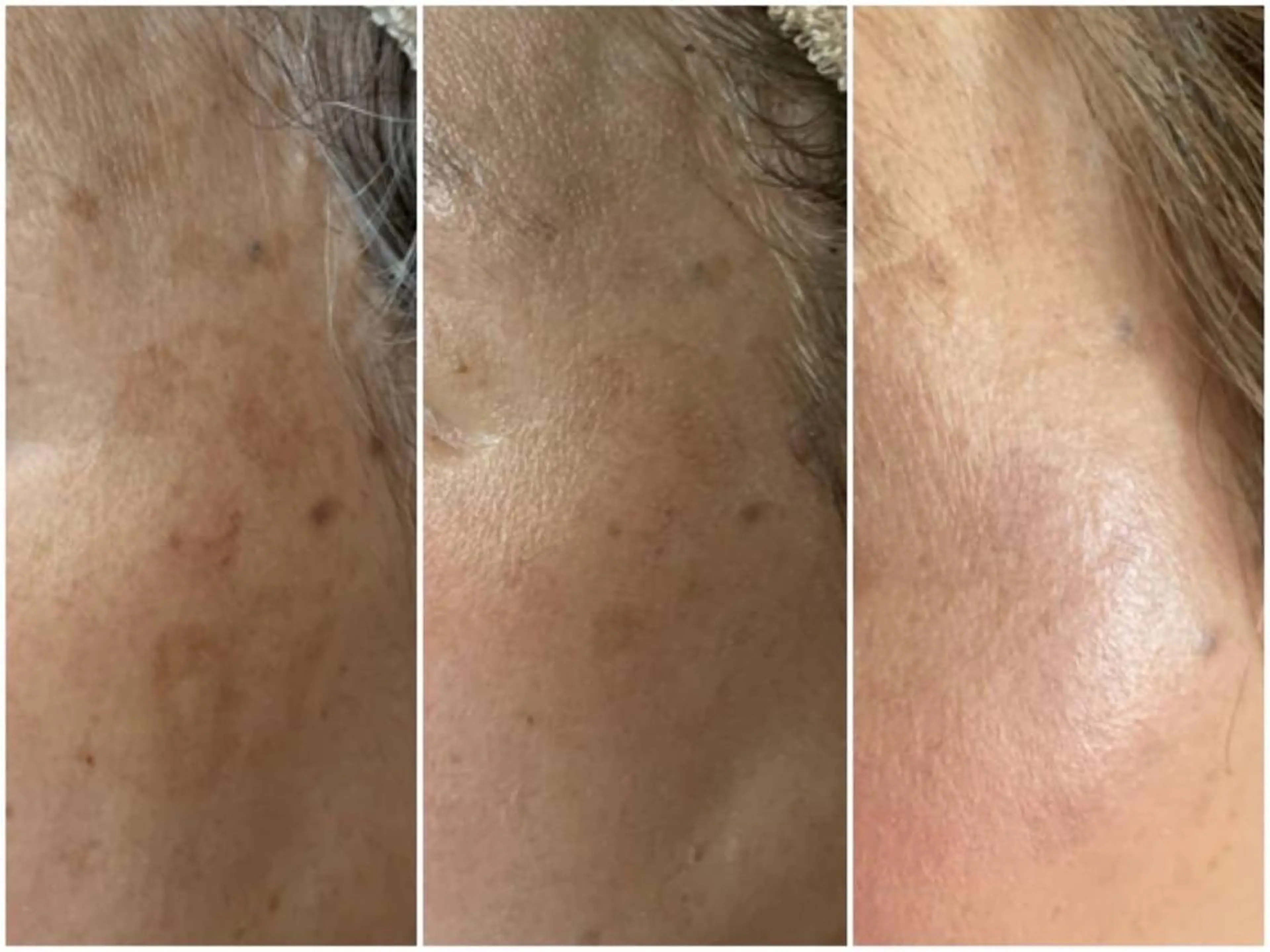 Lumiere despoirのエステ・リラクイメージ