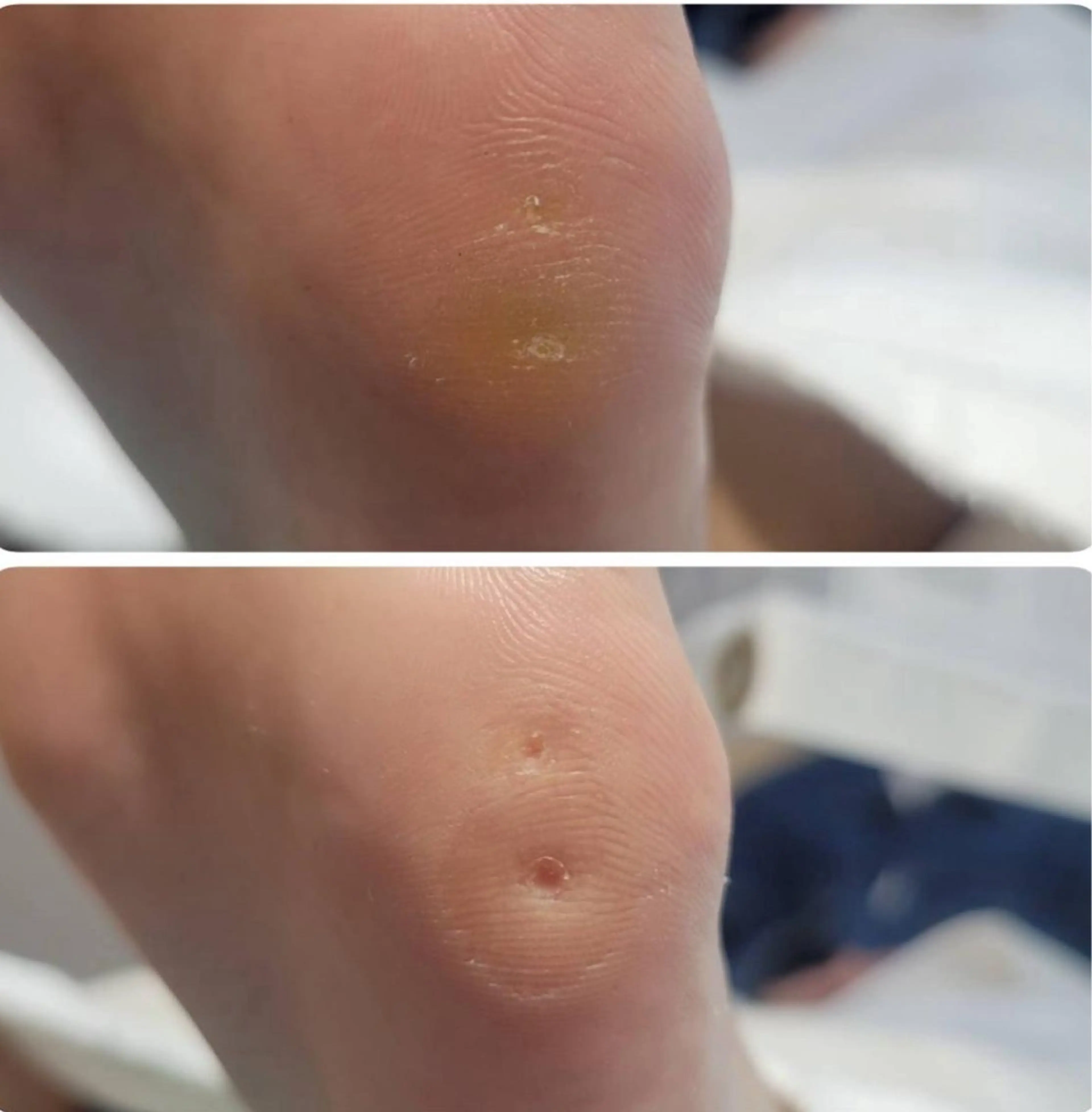 リラク 福岡巻き爪補正店 博多店のエステ・リラクイメージ