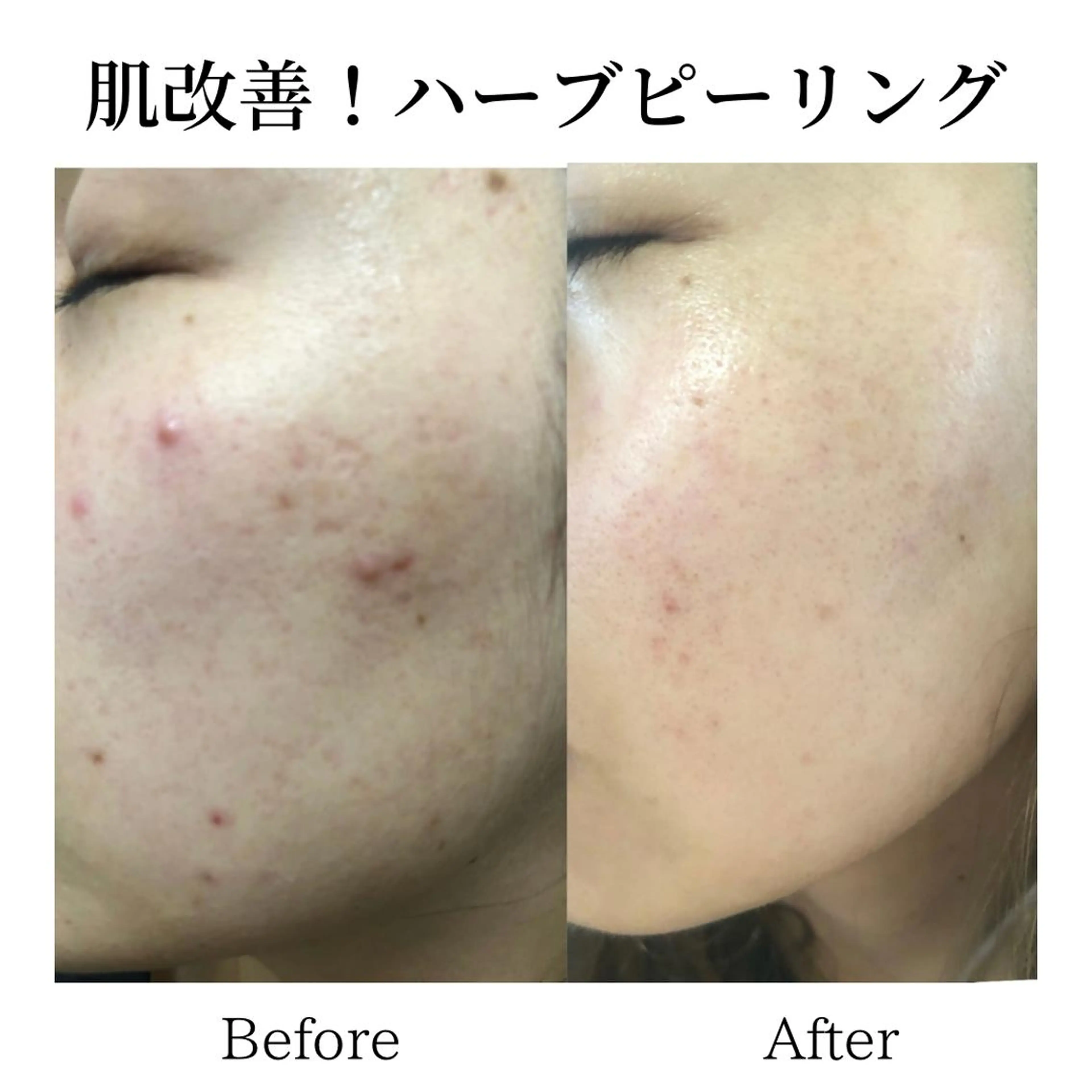 エステサロン Aimer（エメ）所属・エステサロン Aimer（エメ）のエステ・リラクイメージ