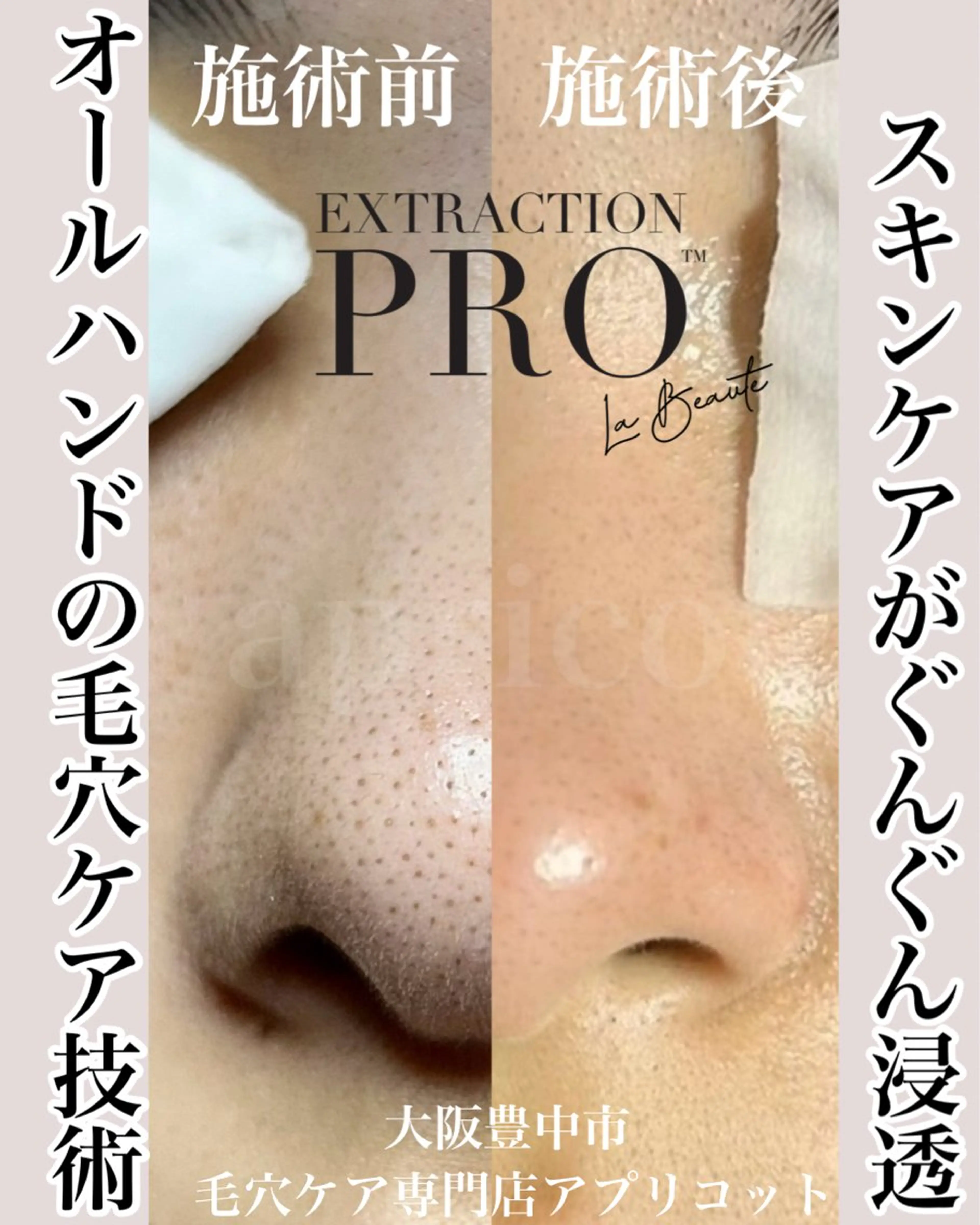 ヘッドスパ専門/豊中 apricotのエステ・リラクイメージ