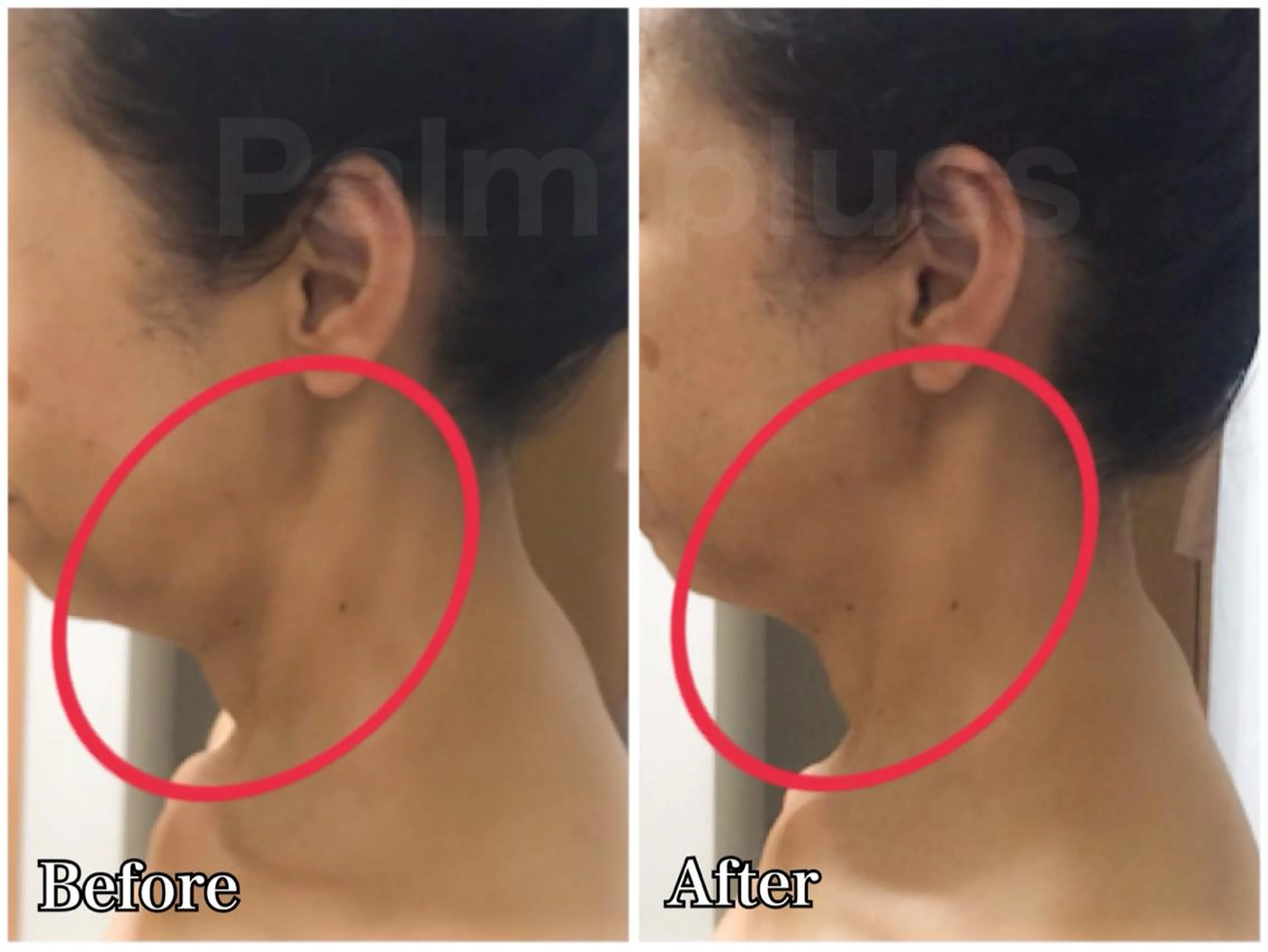 Kalnicco (カルニッコ)のエステ・リラクイメージ