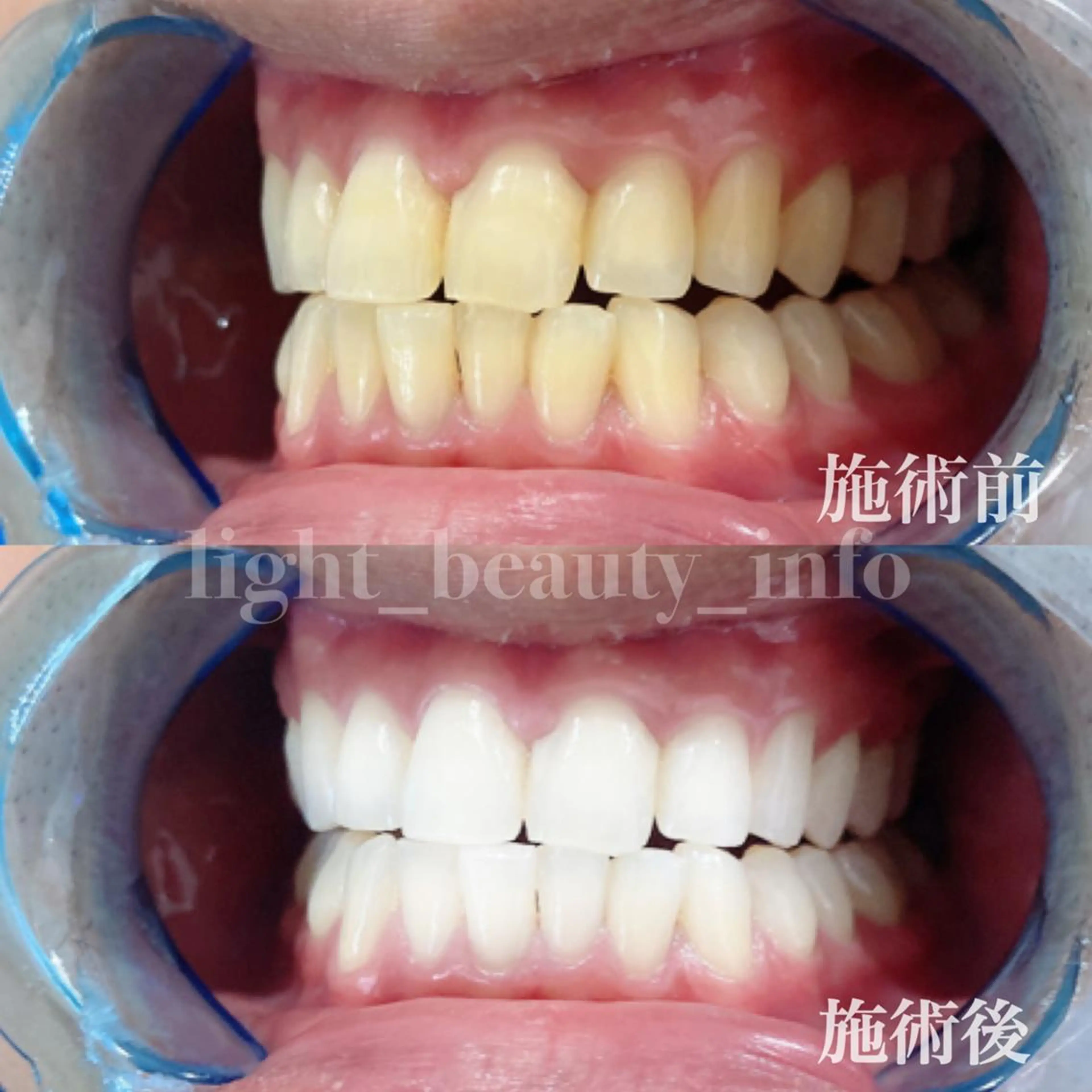 エステ リラク ライトビューティー 錦糸町店のエステ・リラクイメージ