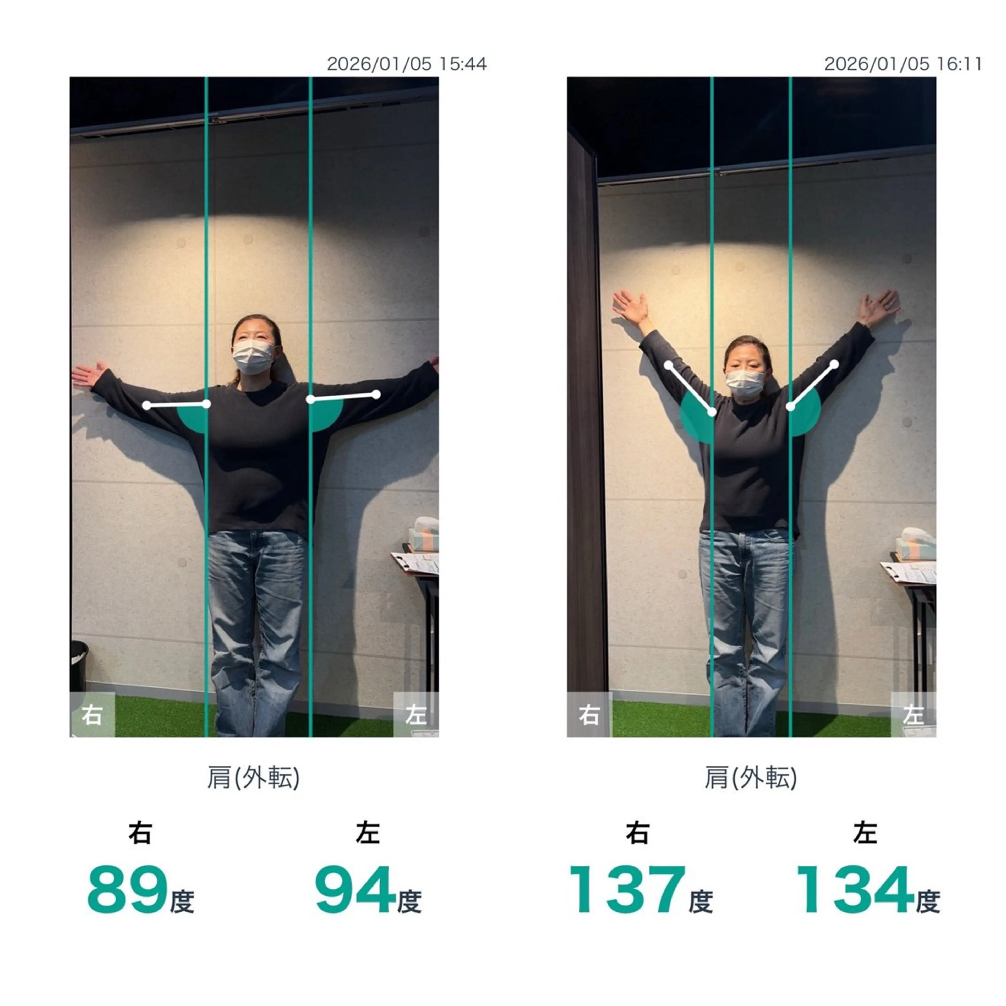 健康×美容鍼鍼灸院 あさば整体院三ノ輪店のエステ・リラクイメージ