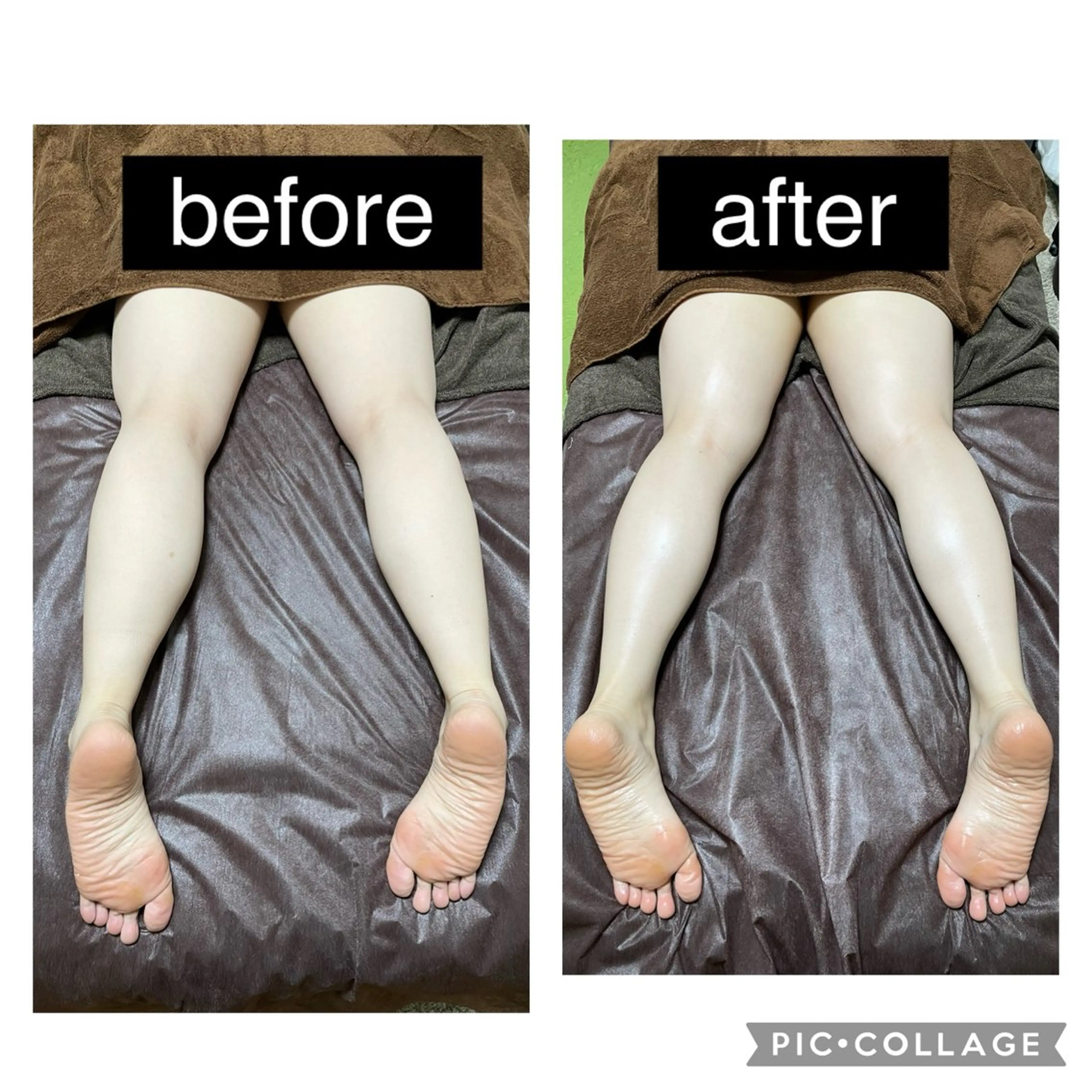 【O脚脱脚！】骨盤の歪み改善・足細メソッド！120分33000円→特価12000円の写真