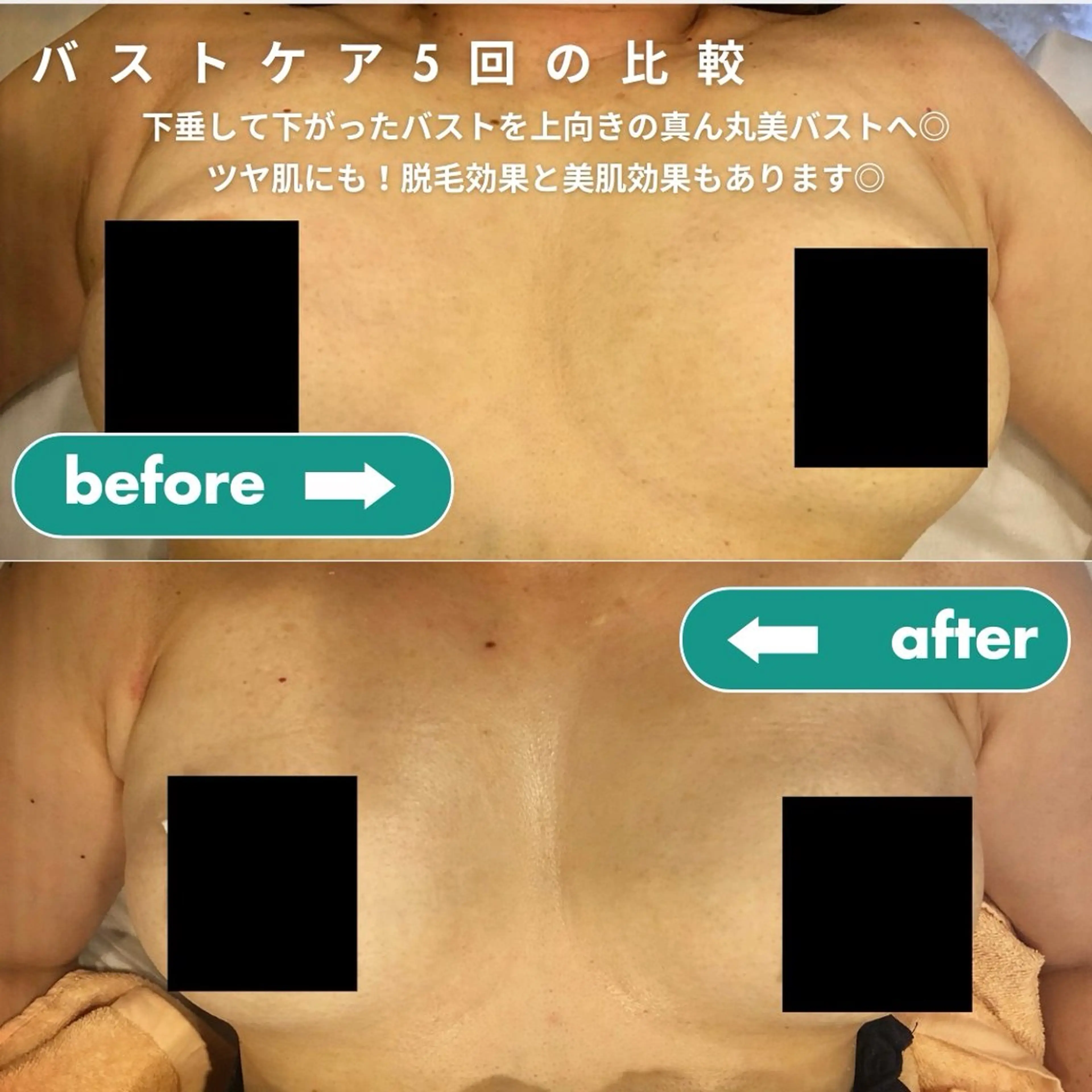 【脱毛・美肌専門】 bellstyleのエステ・リラクイメージ