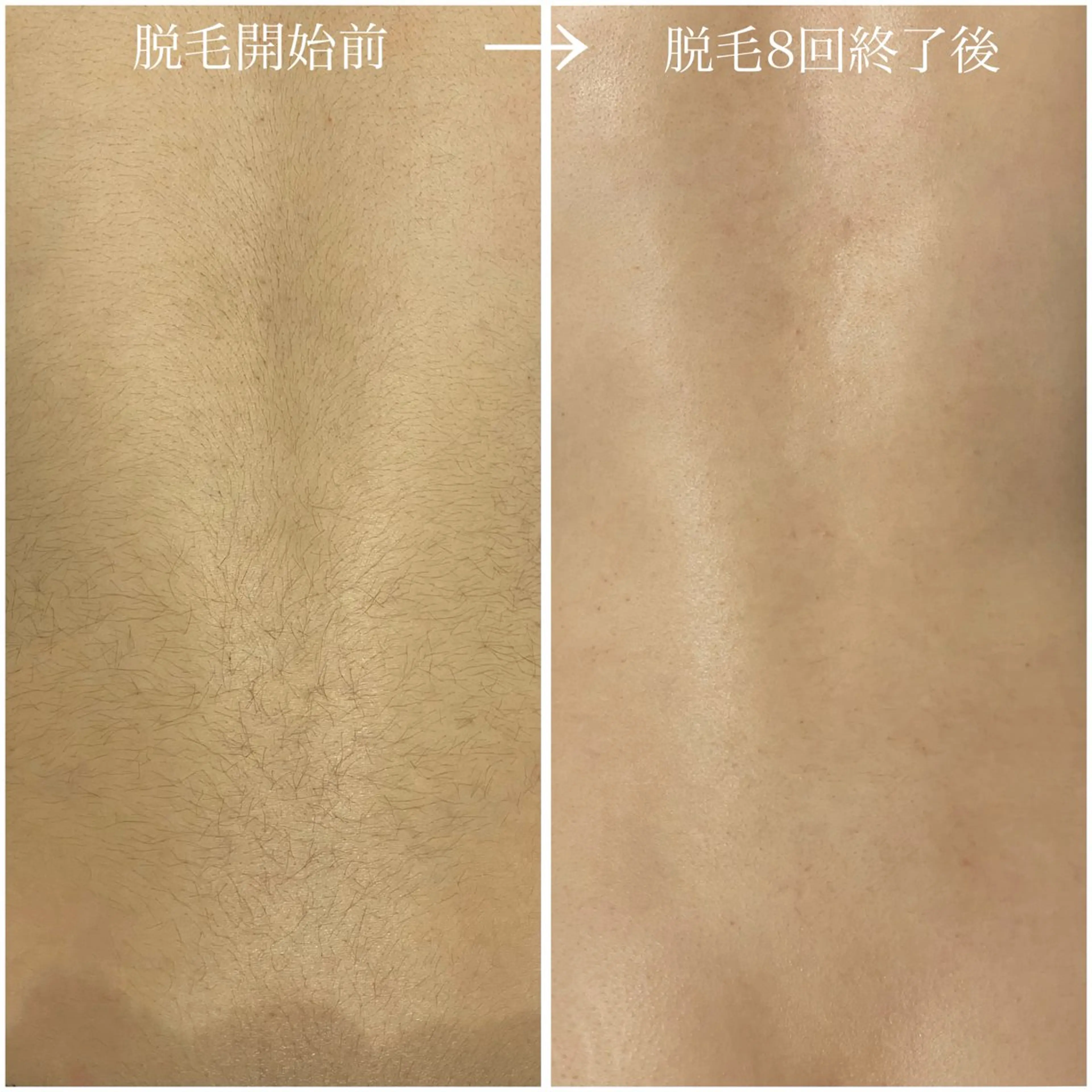 中尾 朱里のエステ・リラクイメージ