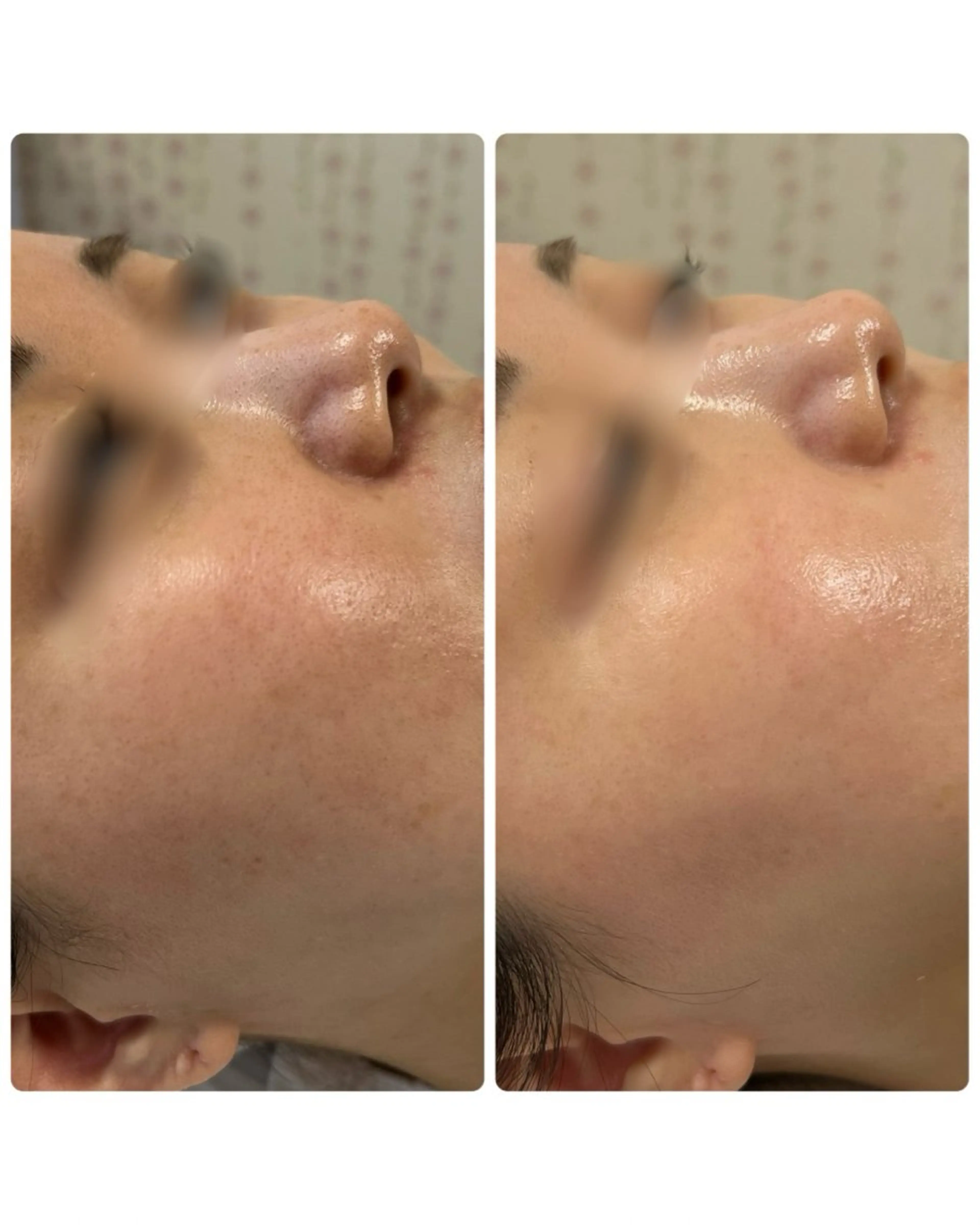 Astorie 相模大野エステのその他イメージ