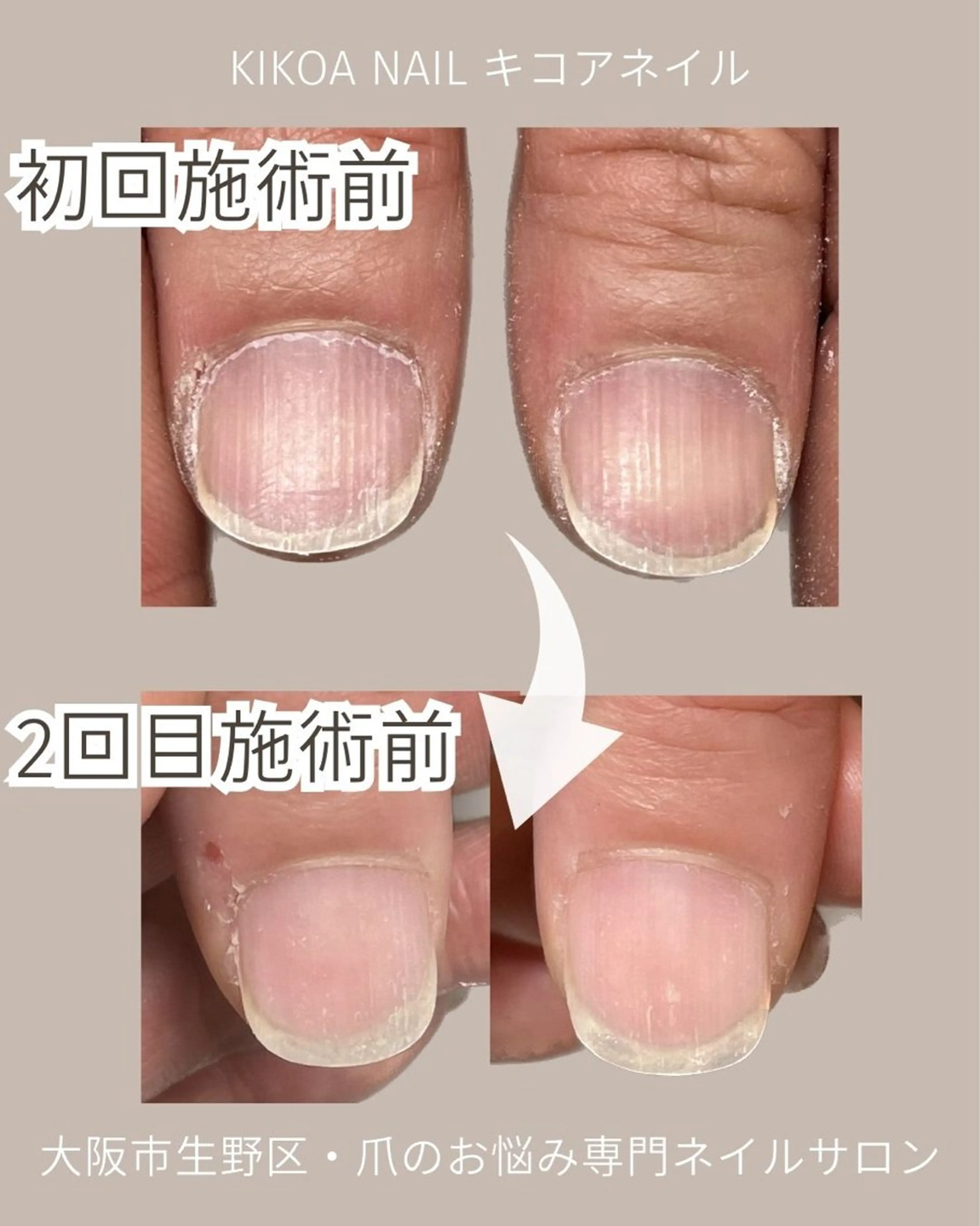 ネイル KIKOA NAIL キコアネイルのネイルデザイン