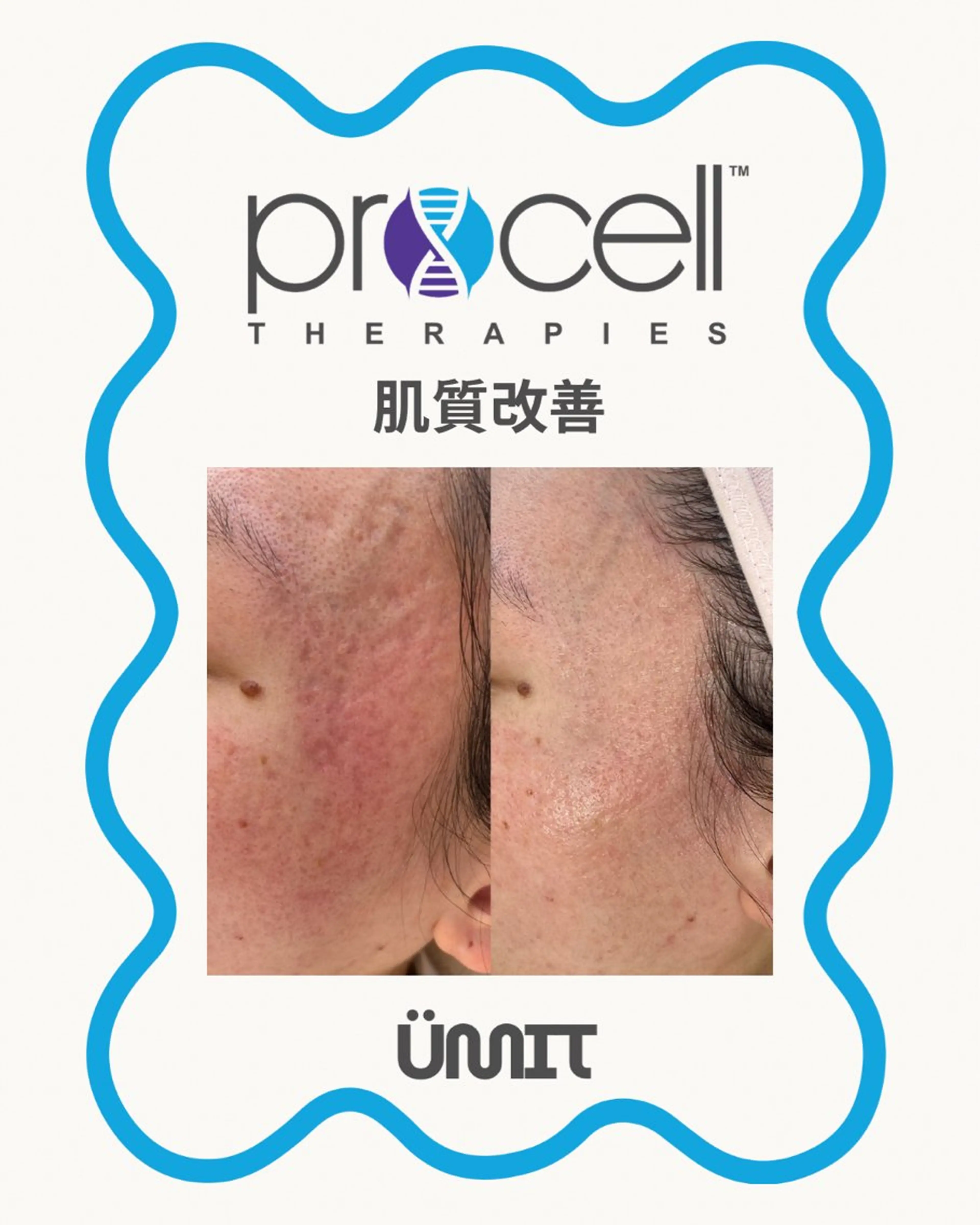 エステ Ümit（ユミト） プロセルセラピーズのネイルデザイン