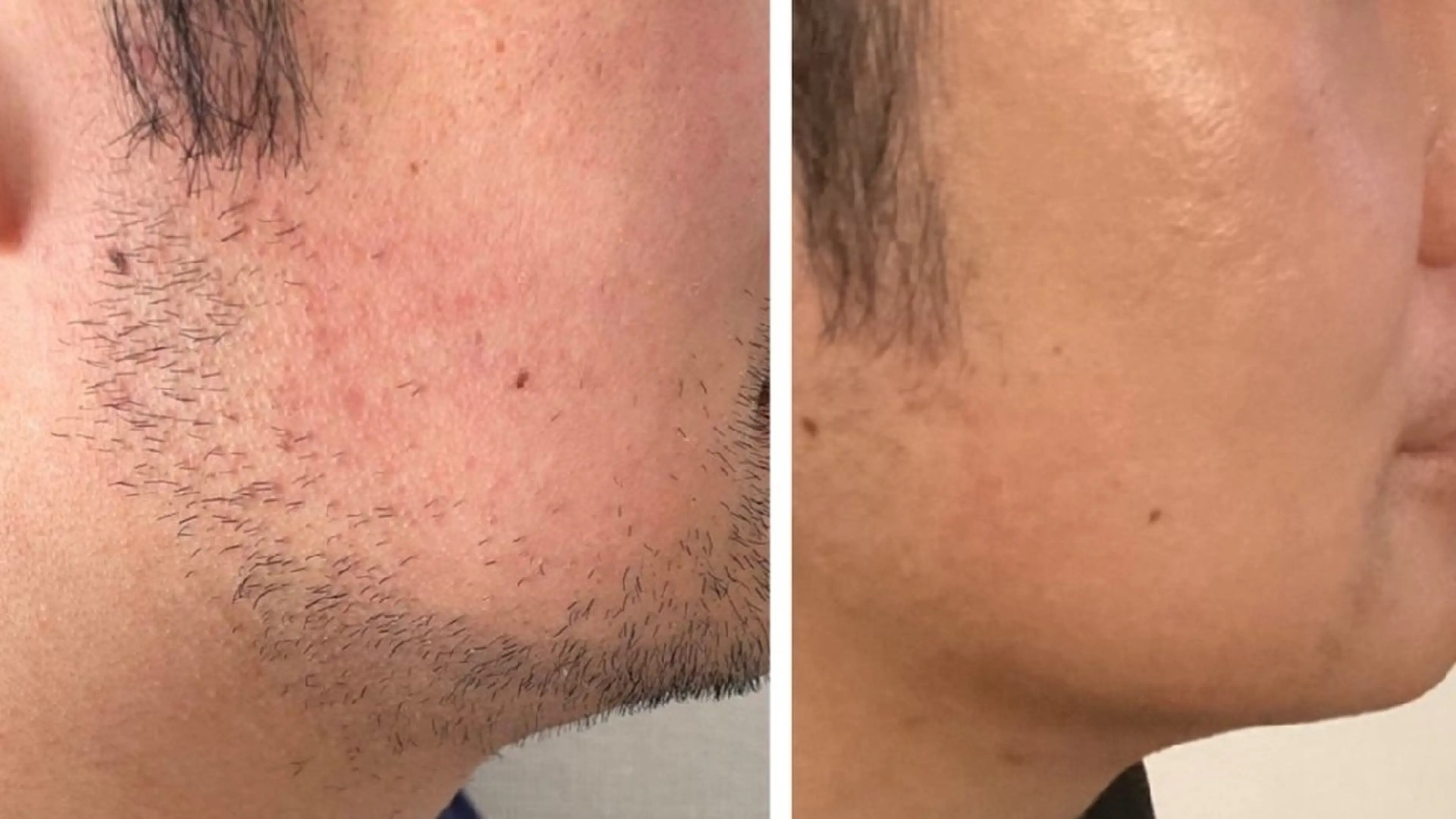 その他 ICHOOSE/ 代々木上原のエステ・リラクイメージ