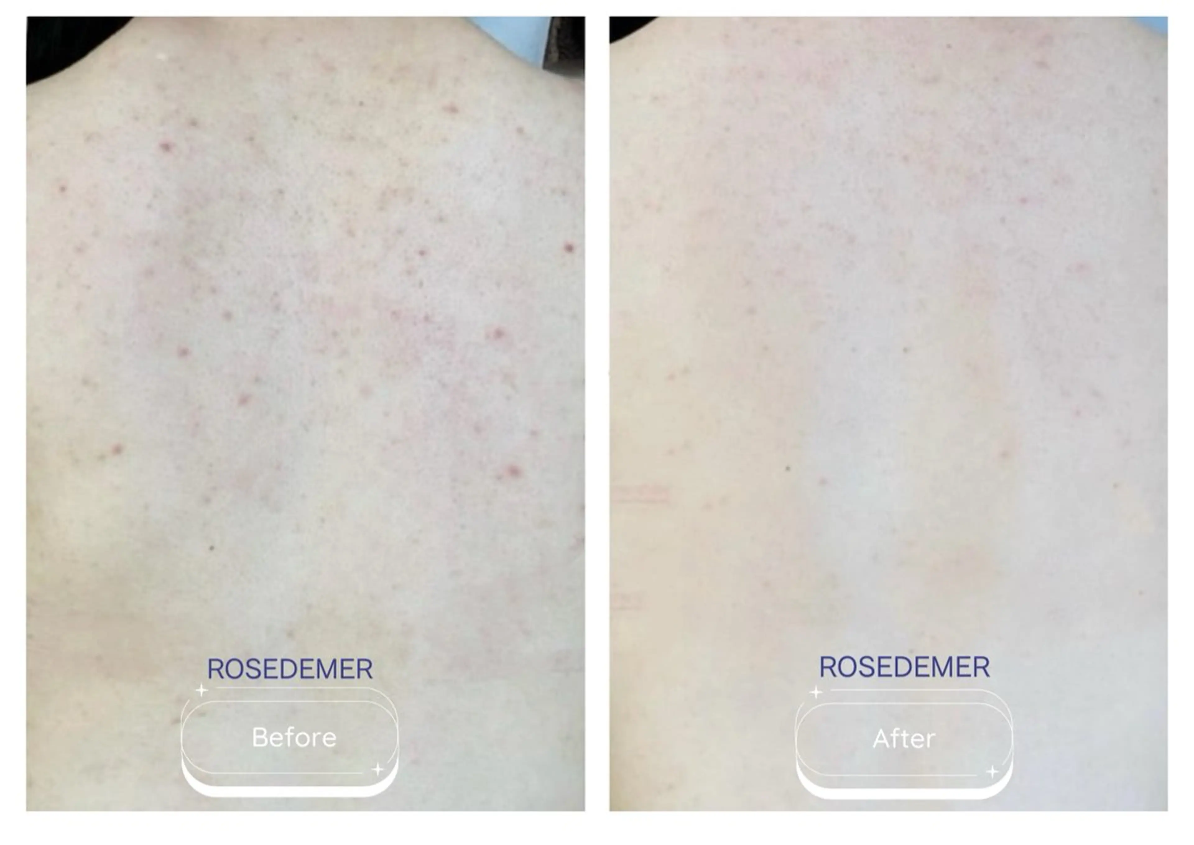 エステ 韓国風eyelush 眉毛サロン/Suuの眉毛・アイブロウイメージ