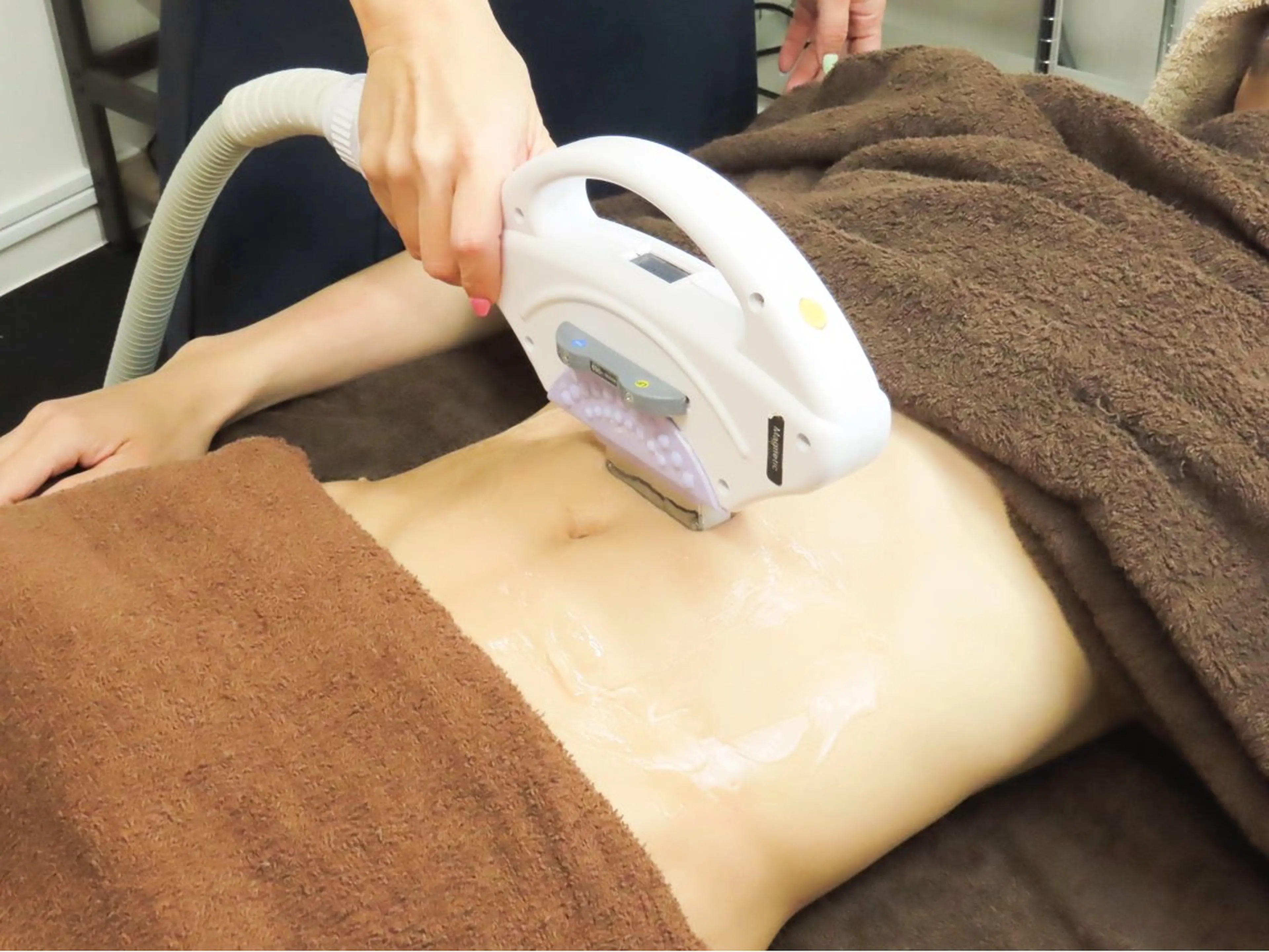 男性全身脱毛(ヒゲ、VIO込）メンズの写真