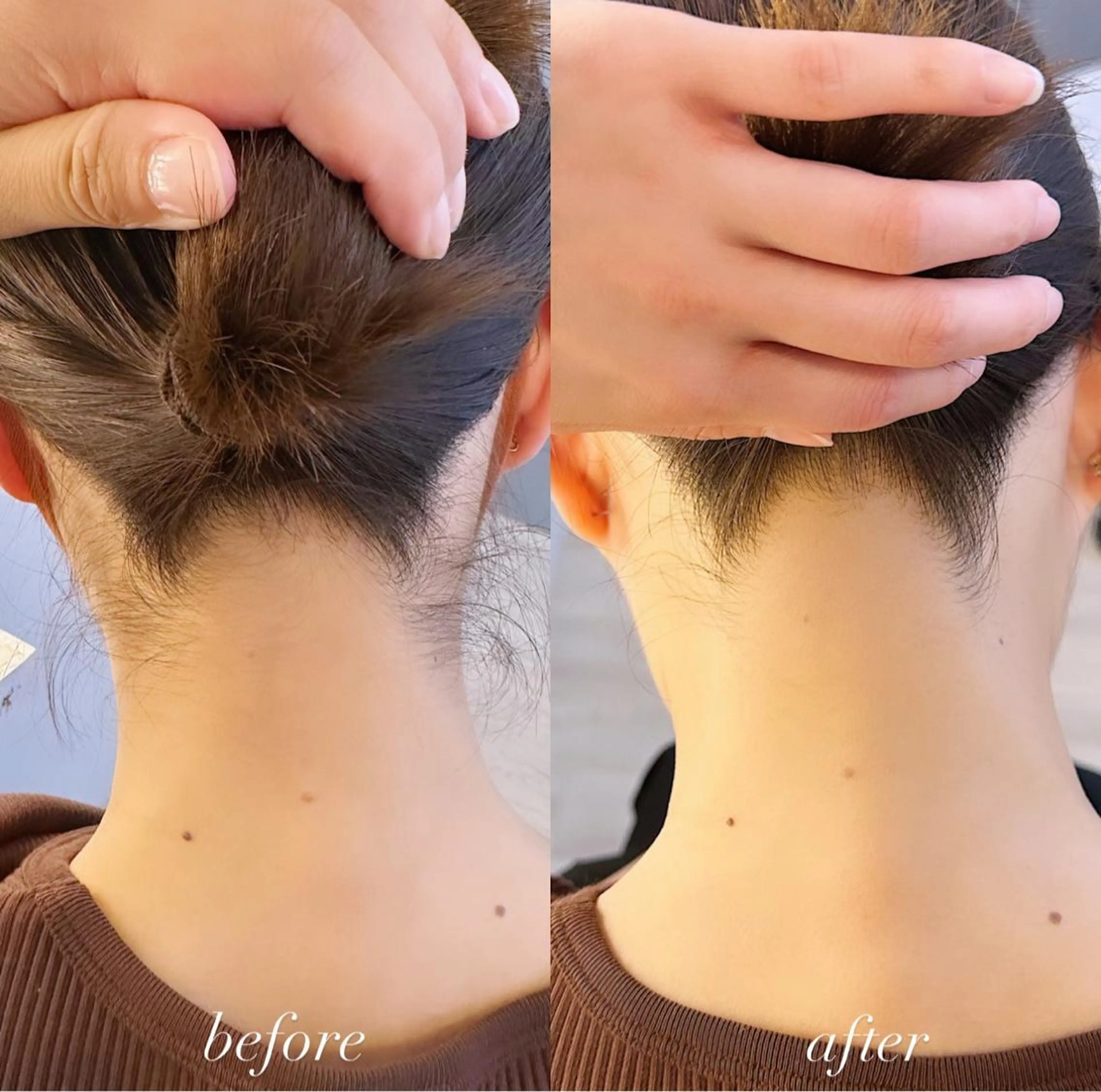 うなじ脱毛/美肌脱毛 LABELのエステ・リラクイメージ