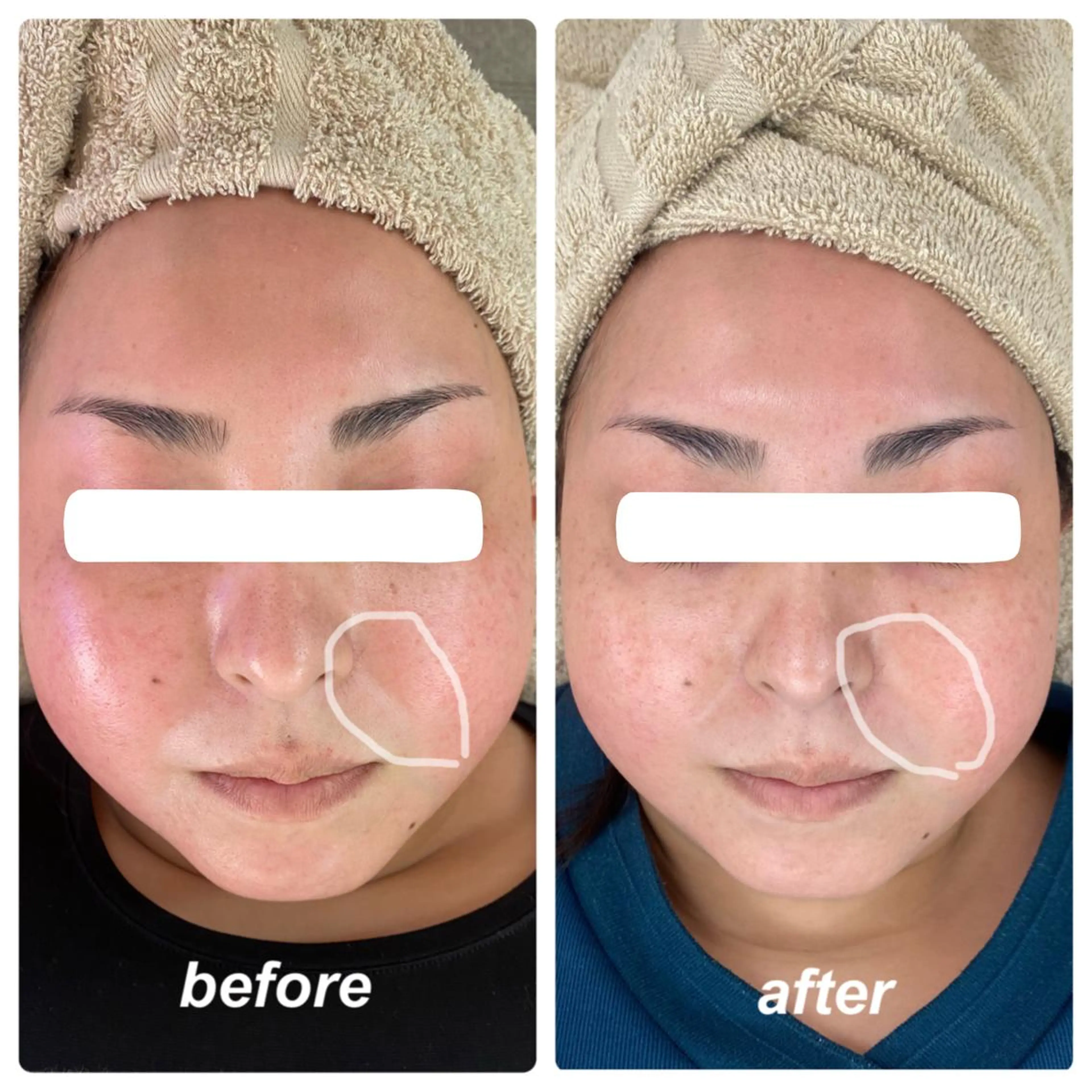 エステ Venus所属・エステサロン Venusのその他イメージ