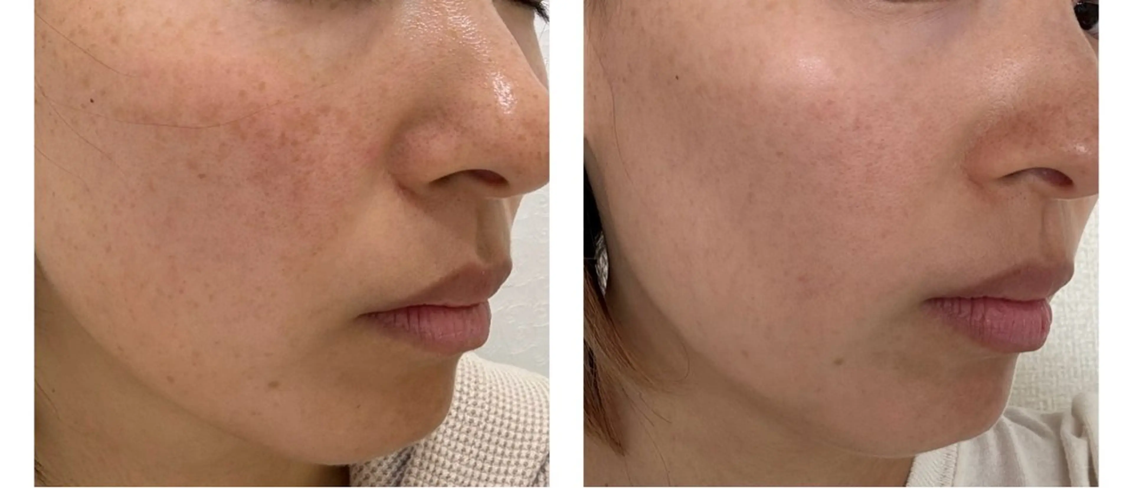 エステ リラク marrina terraceのエステ・リラクイメージ