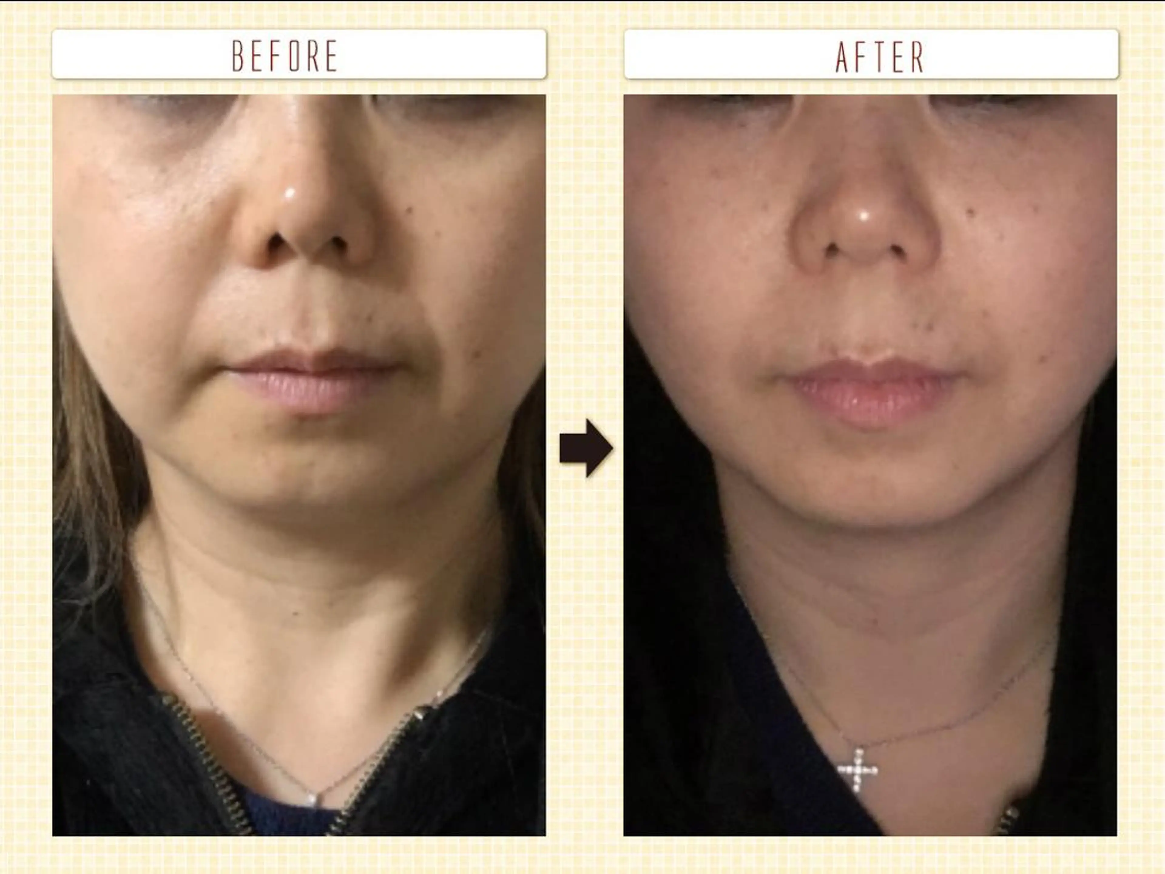 A.mstic 美肌、美ボディ専門店のエステ・リラクイメージ