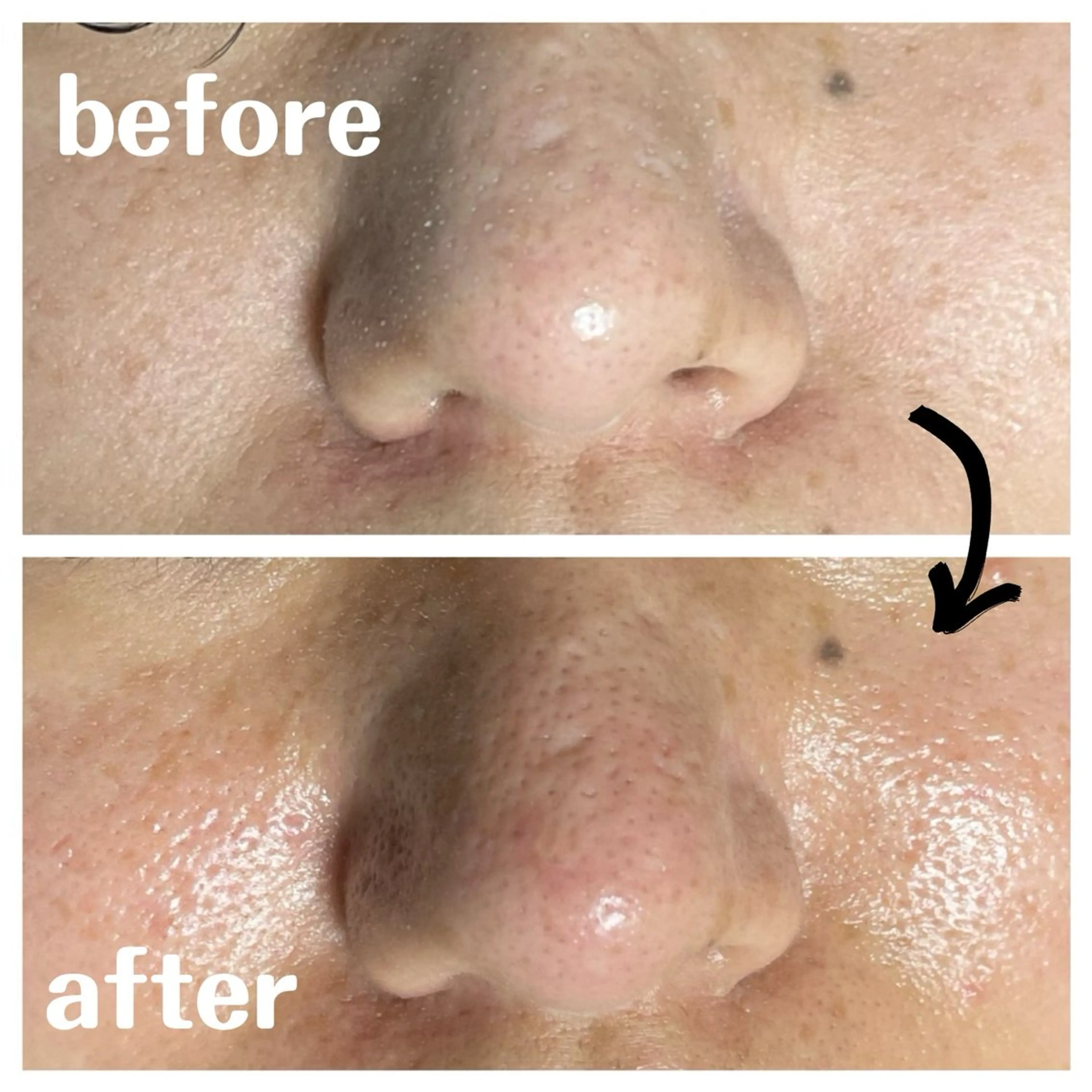 肌質改善エステ chiffonのエステ・リラクイメージ