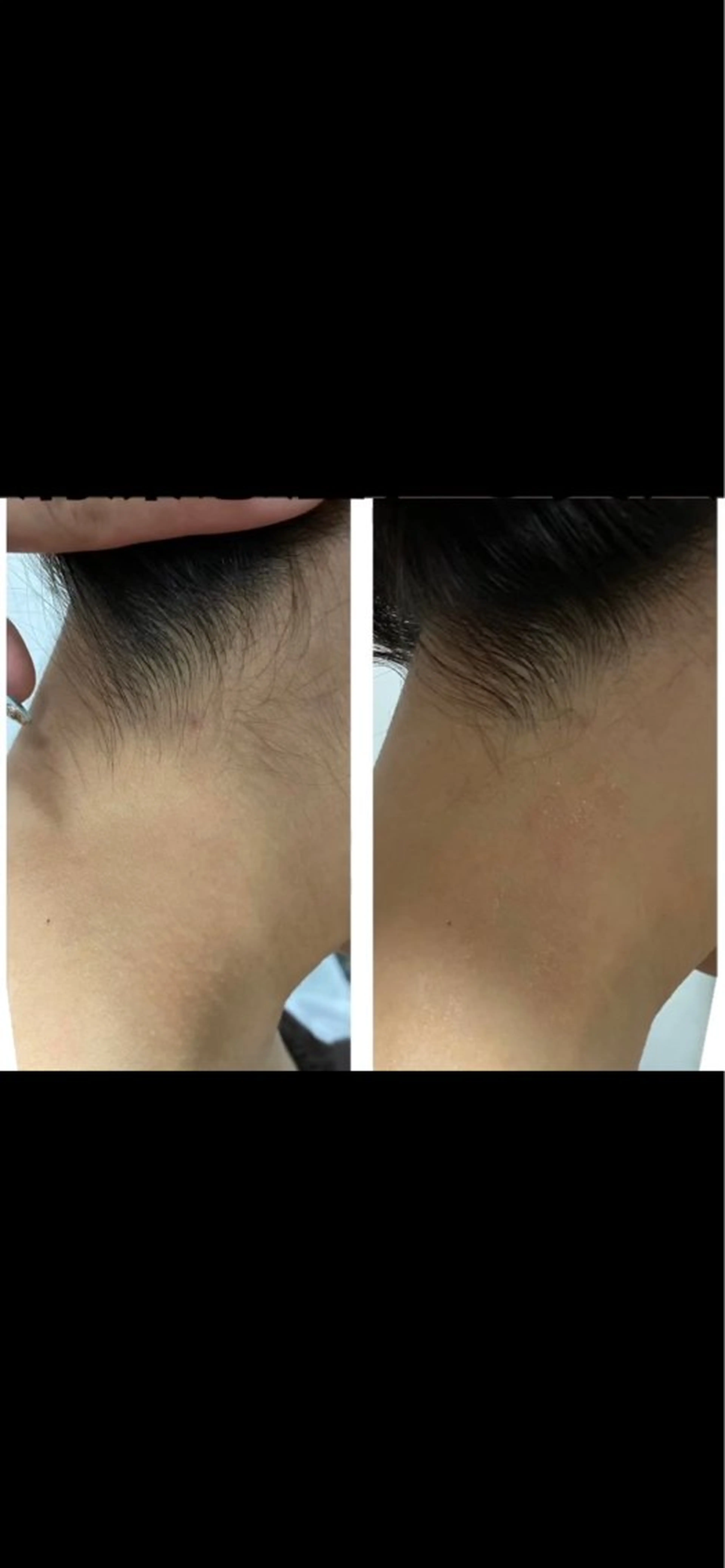 脱毛 Lumus Solarumのエステ・リラクイメージ