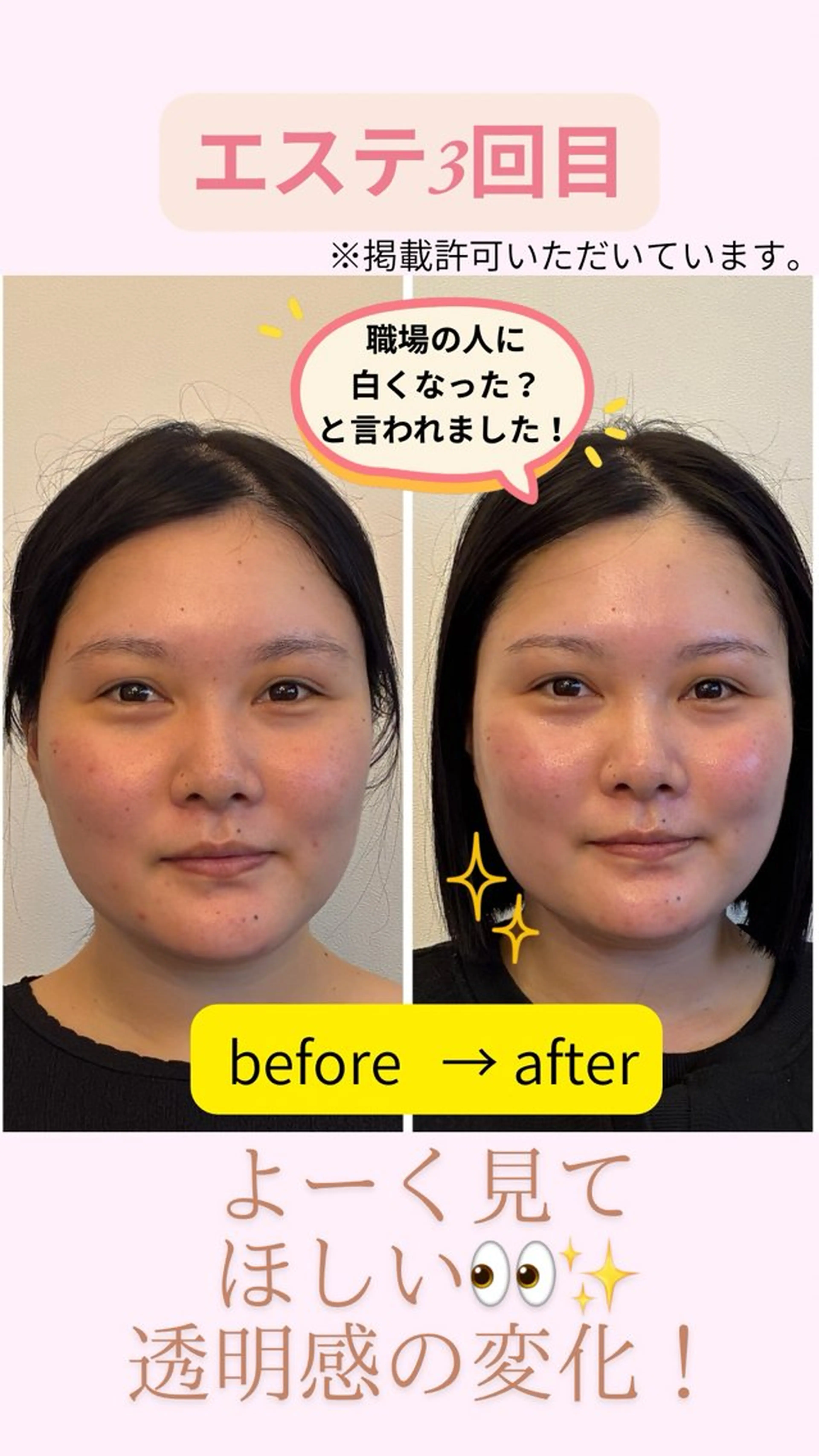 エステ リラク フェイシャルサロン ビアンカガーデンのエステ・リラクイメージ