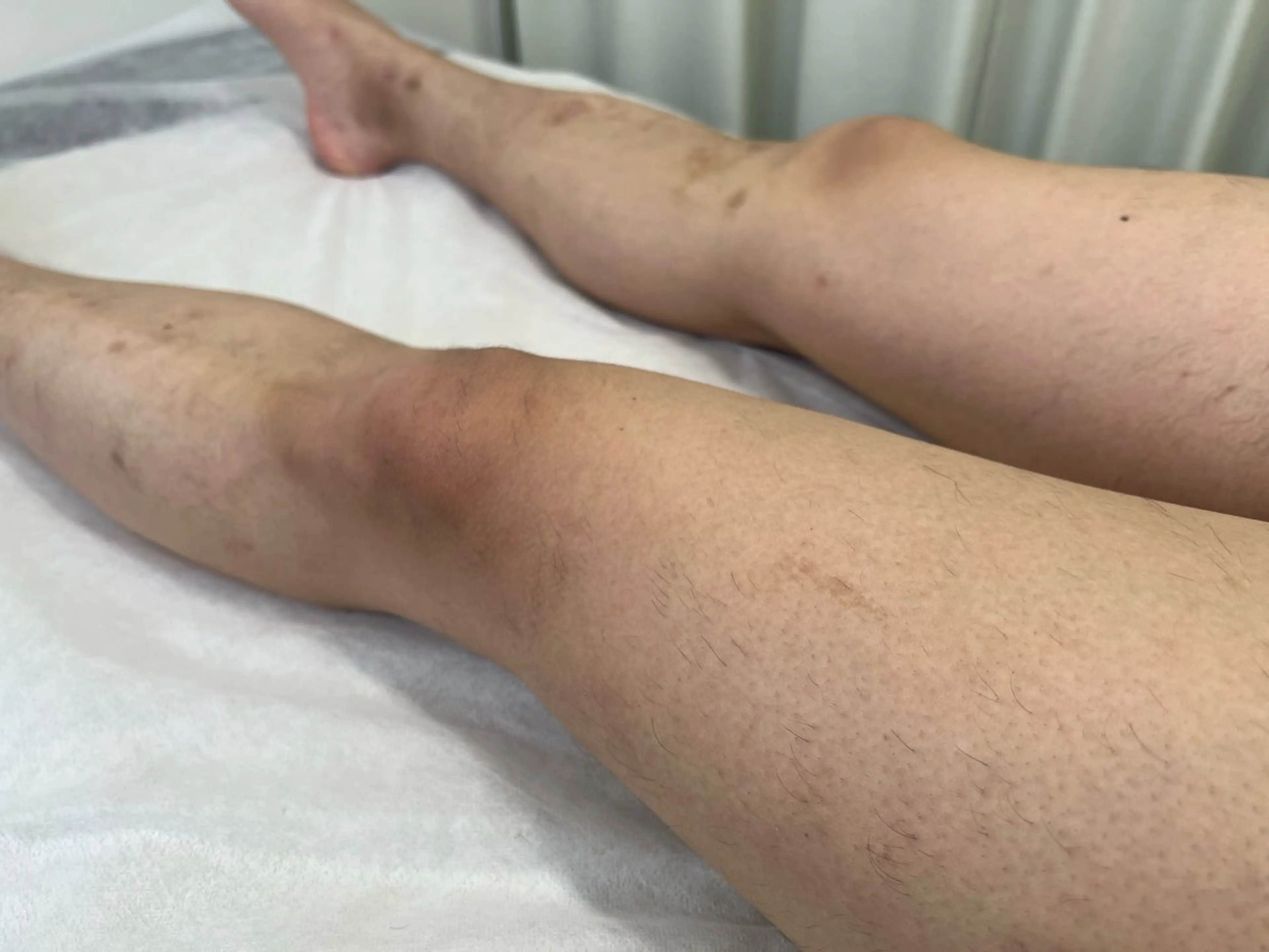 メンズ 脱毛 瀬戸 梨子のエステ・リラクイメージ