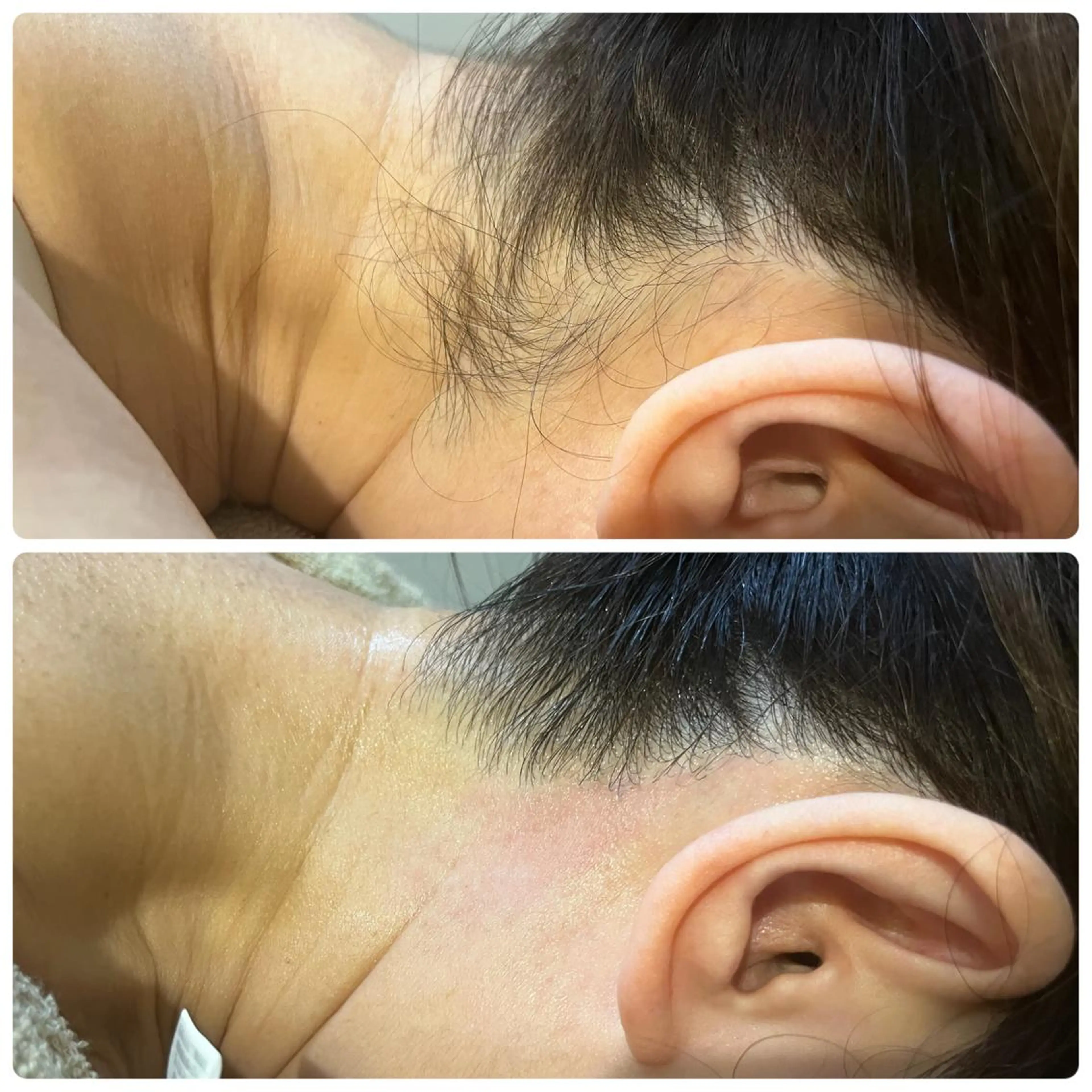 脱毛 【 十美 】 ENDOのエステ・リラクイメージ