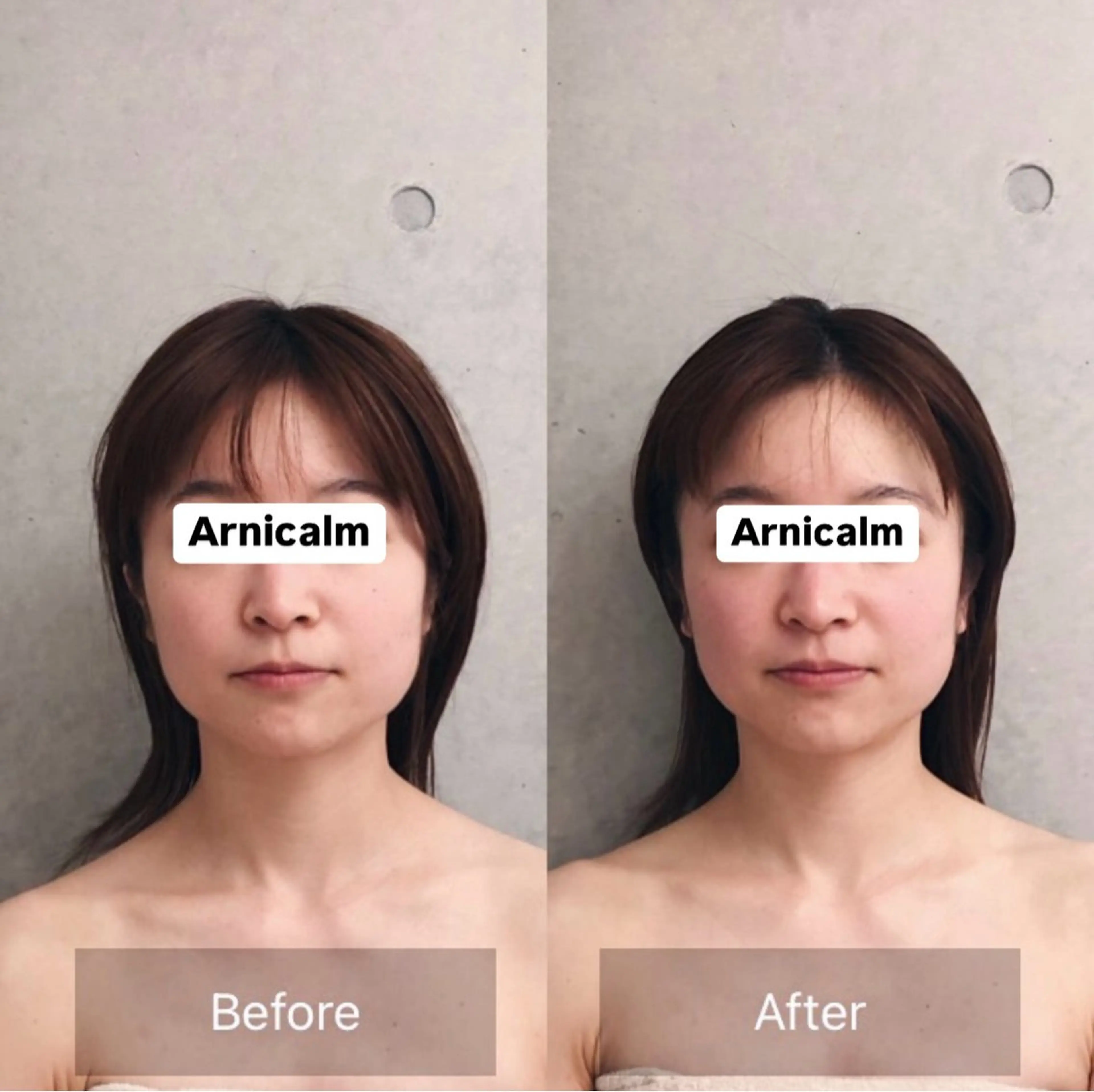 ハーブピーリング 肌再生ピーリング/のエステ・リラクイメージ