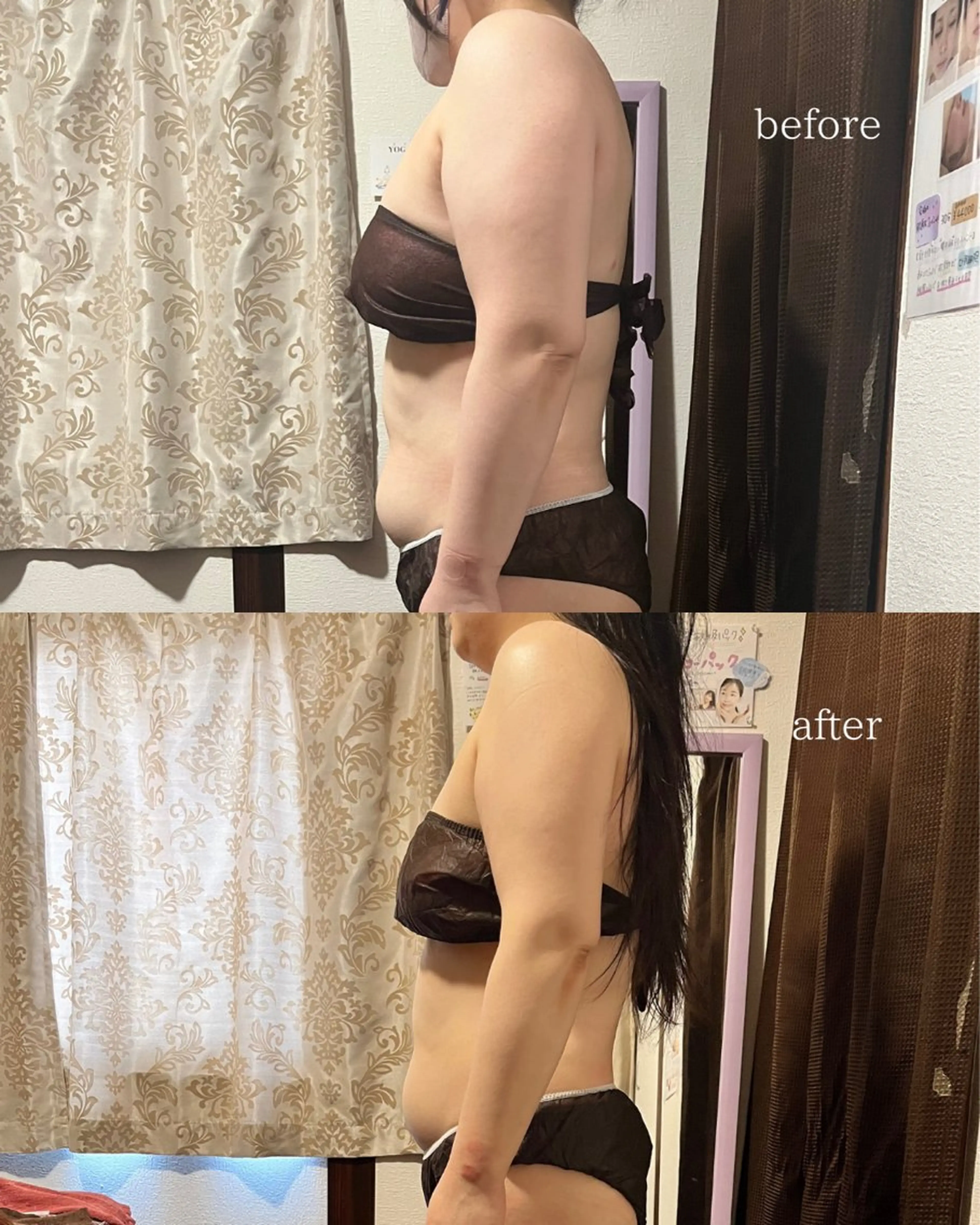 シミ・毛穴ケア専門 クロヌYUKIのエステ・リラクイメージ