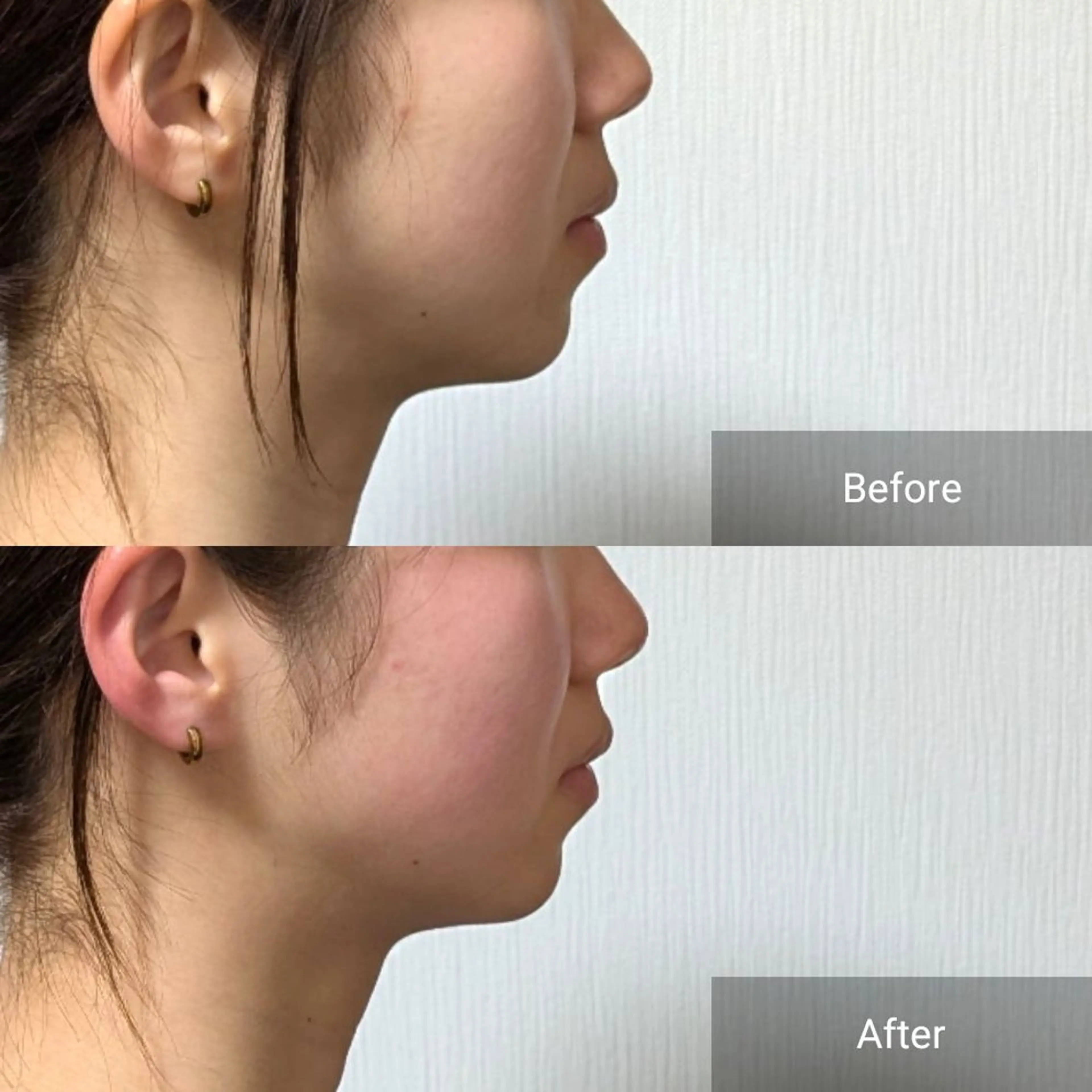 エステ nail RiRi アトレナチュラのエステ・リラクイメージ